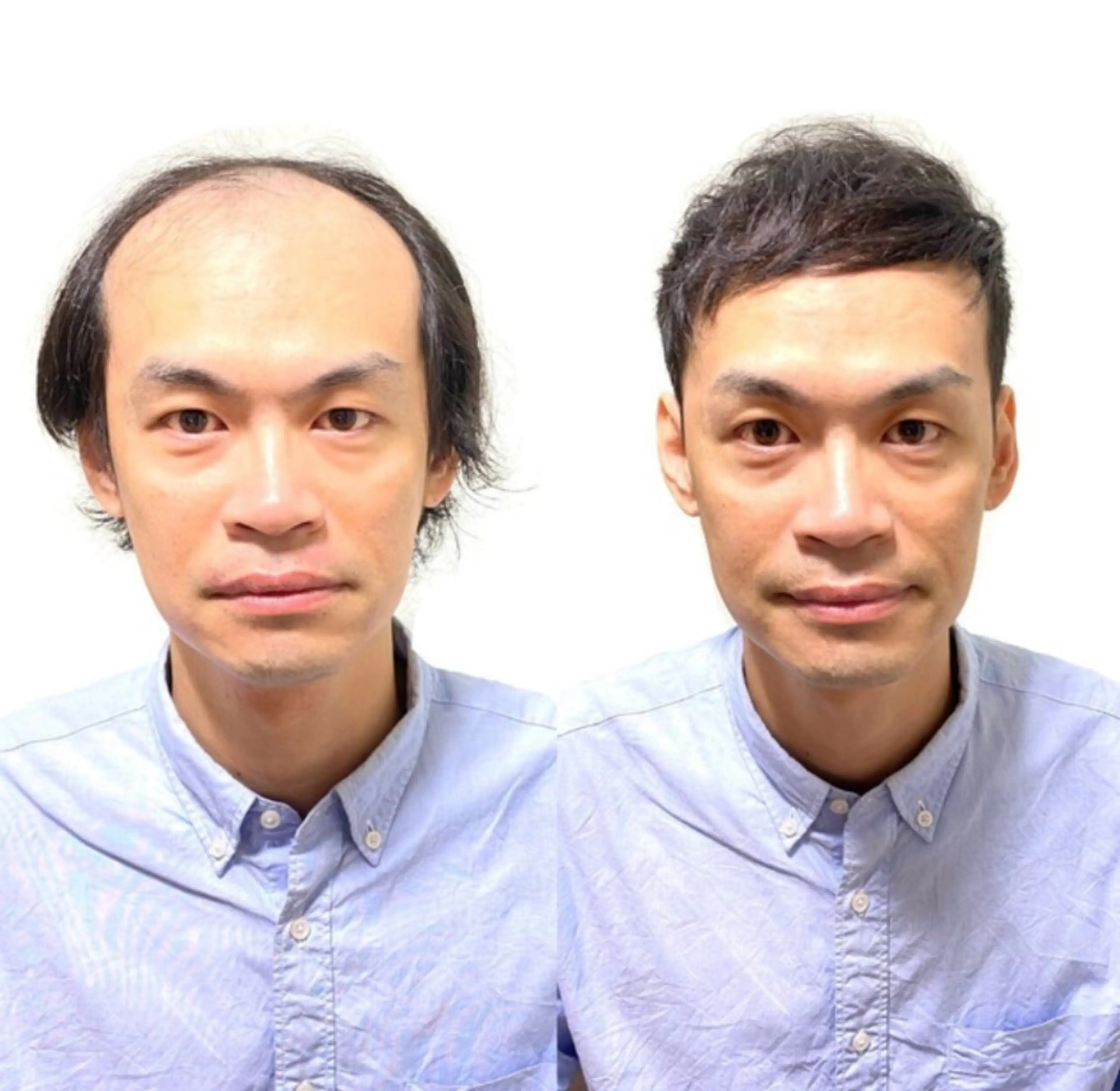 メンズ 薄毛専門美容師 和久井博のその他イメージ