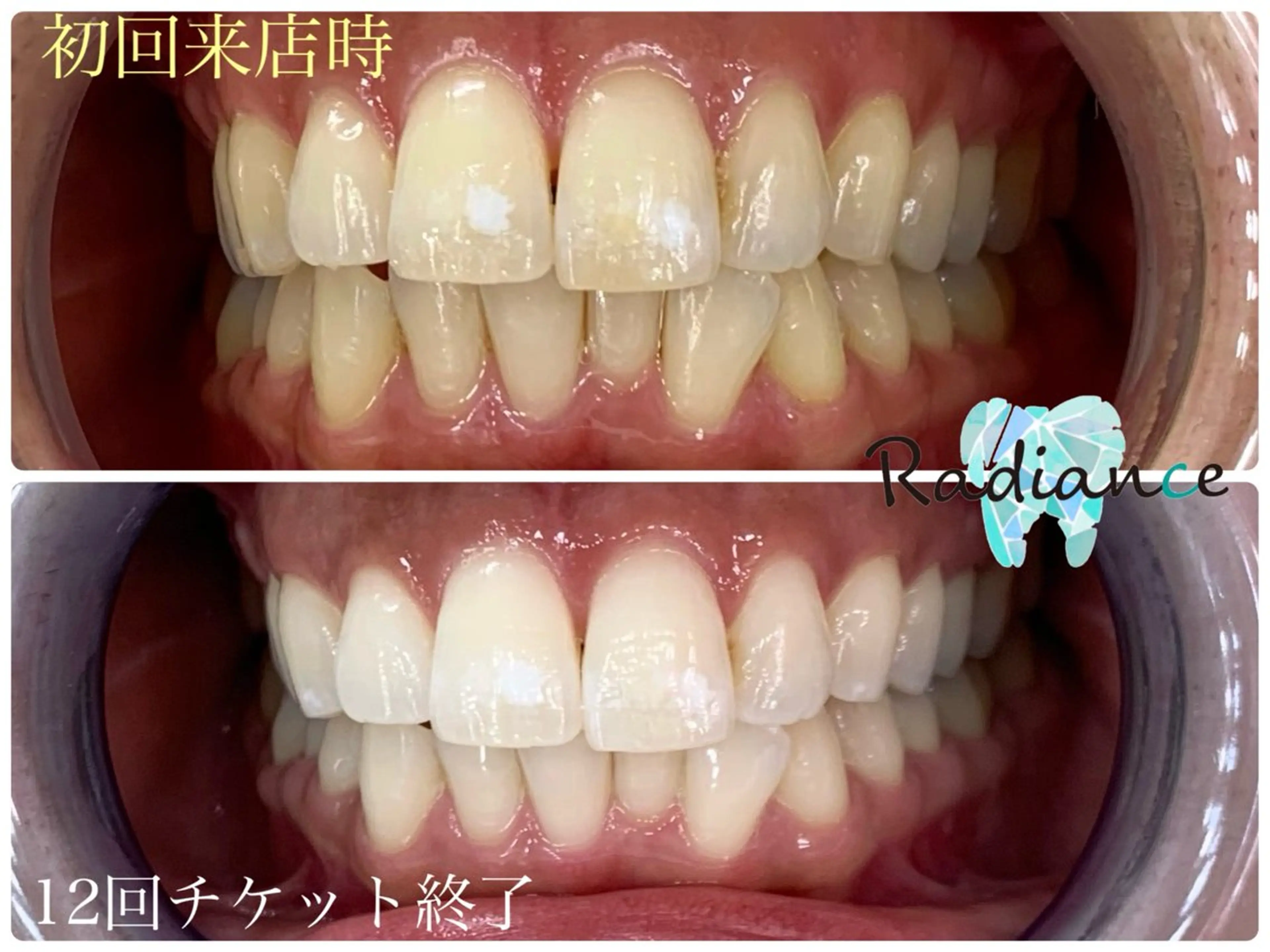 札幌ホワイトニング ラディアンス札幌駅店のその他イメージ