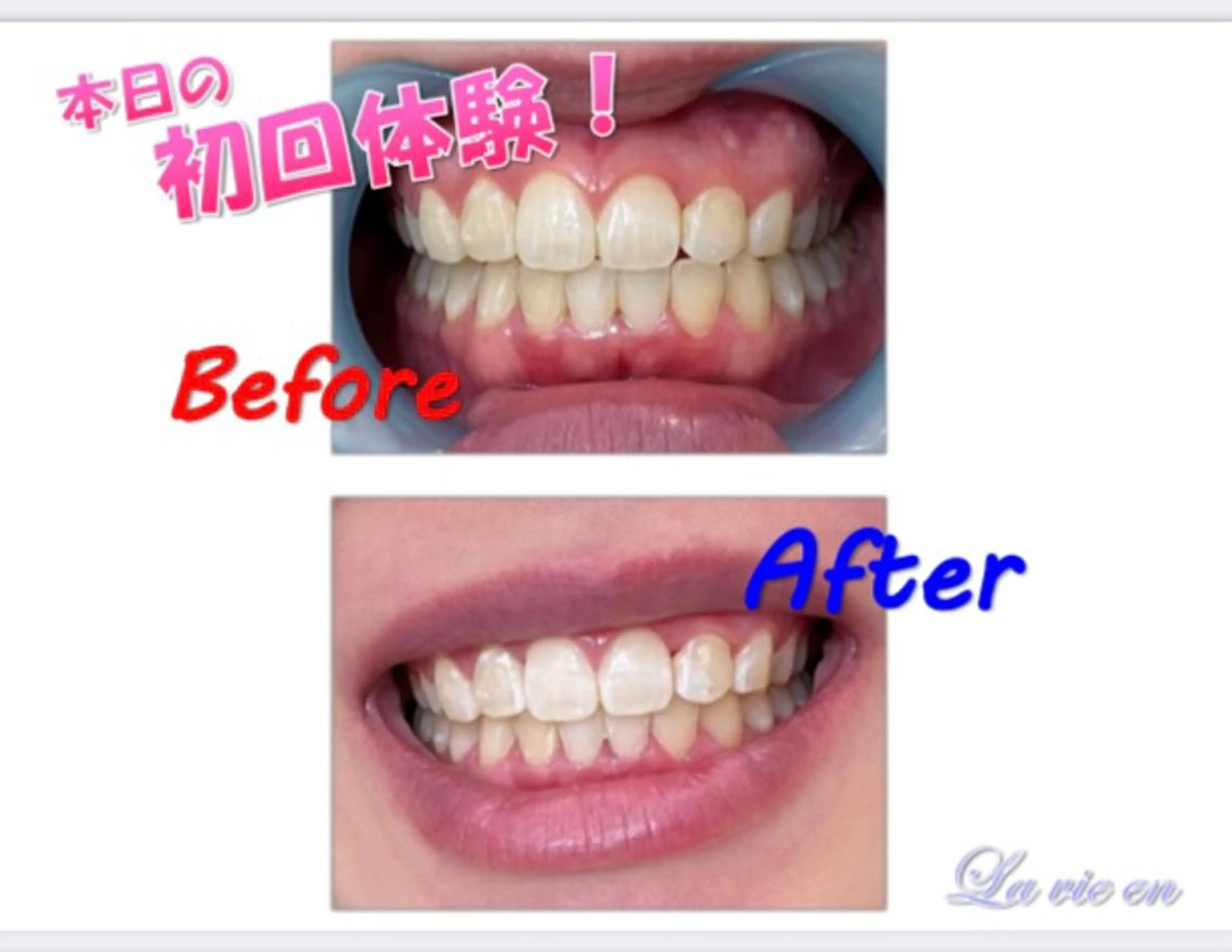 その他 セルフホワイトニングサロン　ラヴィアン所属・ホワイトニングサロン La vie enのその他イメージ