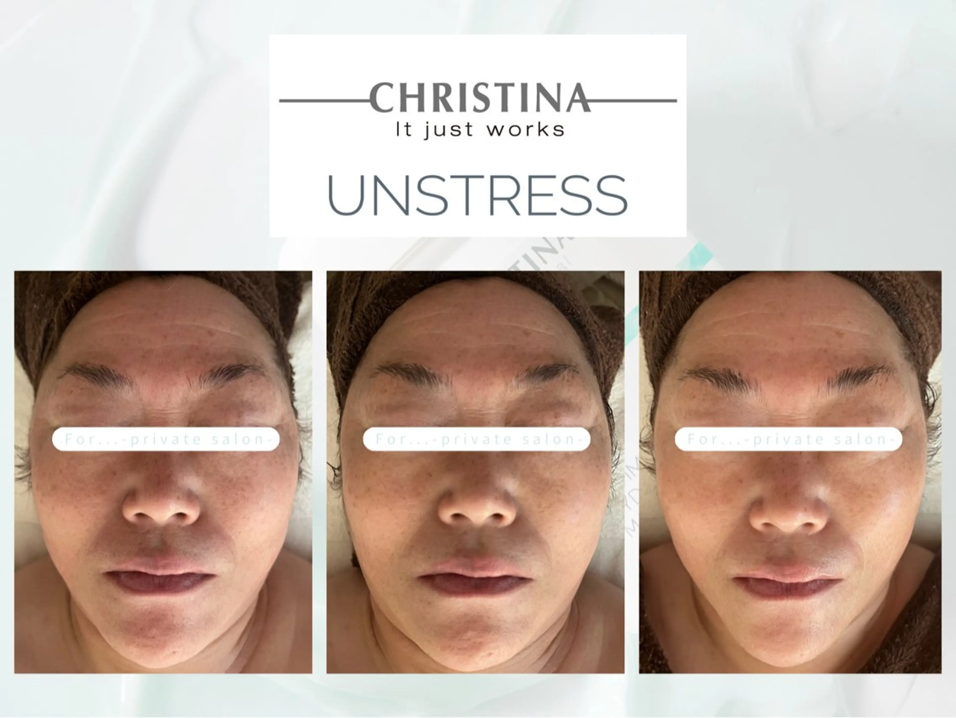 エステ 肌質改善|天王寺 For...はるかのエステ・リラクイメージ