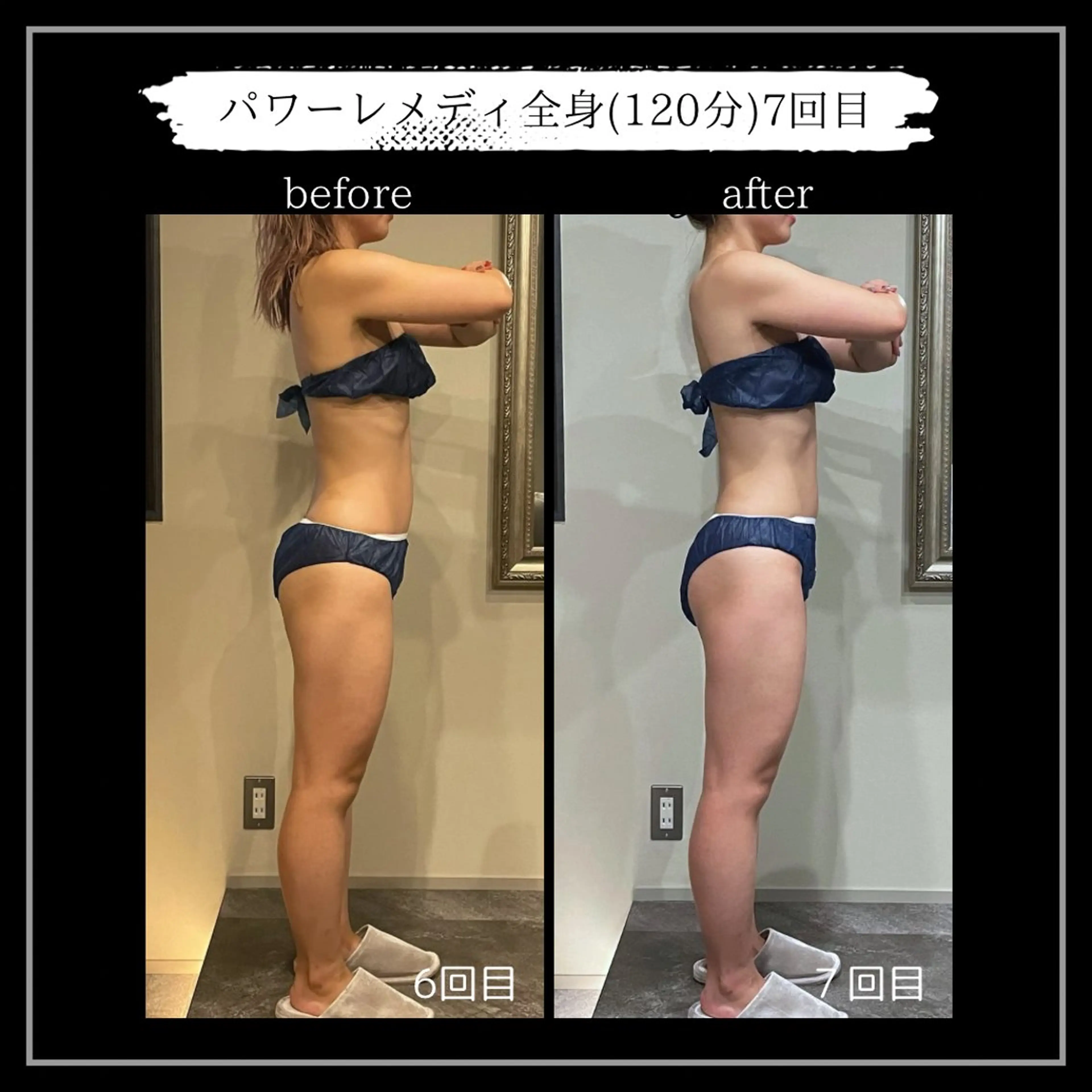 オフ:オン所属・オフ:オン 全身筋膜マッサージのエステ・リラクイメージ