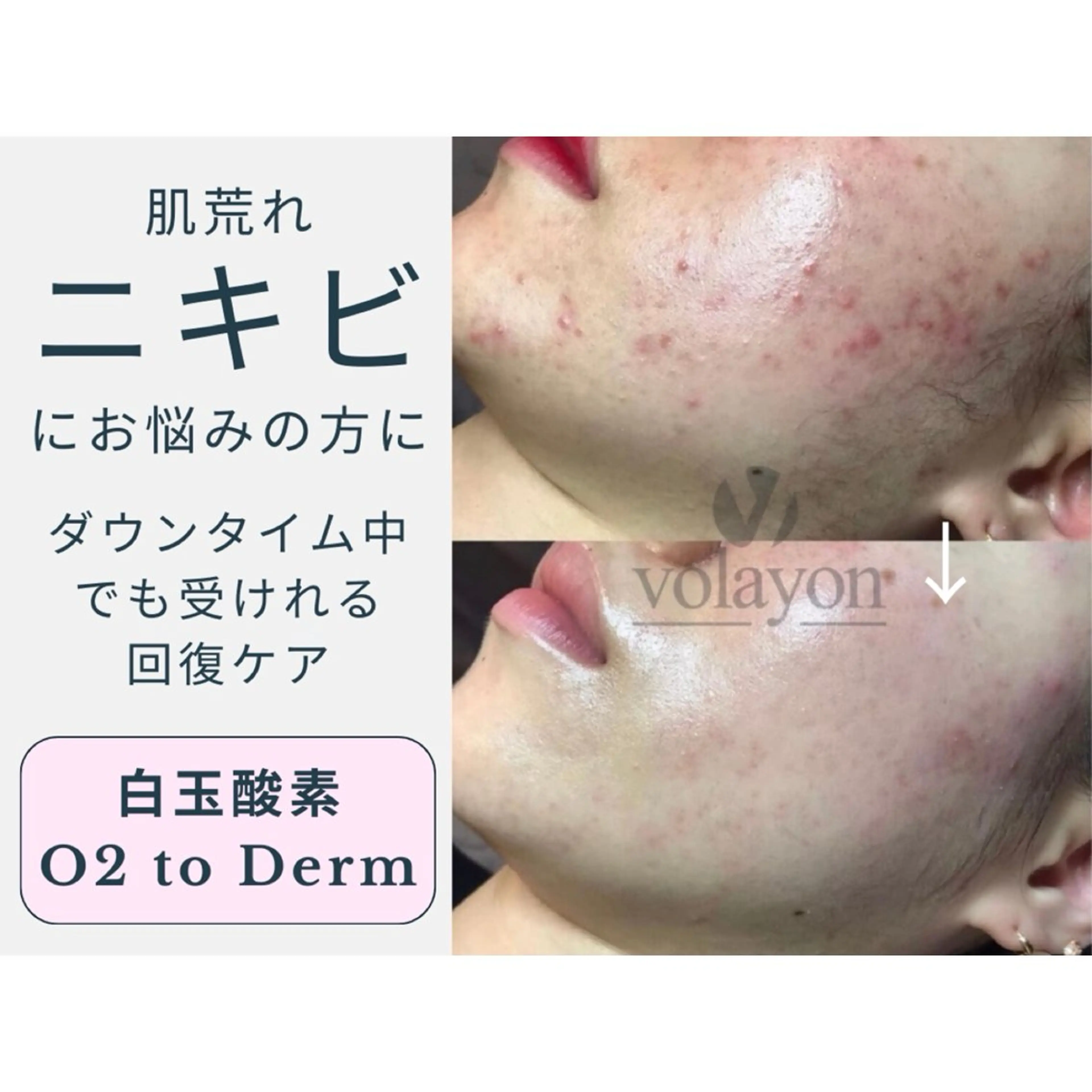 エステ swan(スワン) 韓国肌管理 南堀江のエステ・リラクイメージ