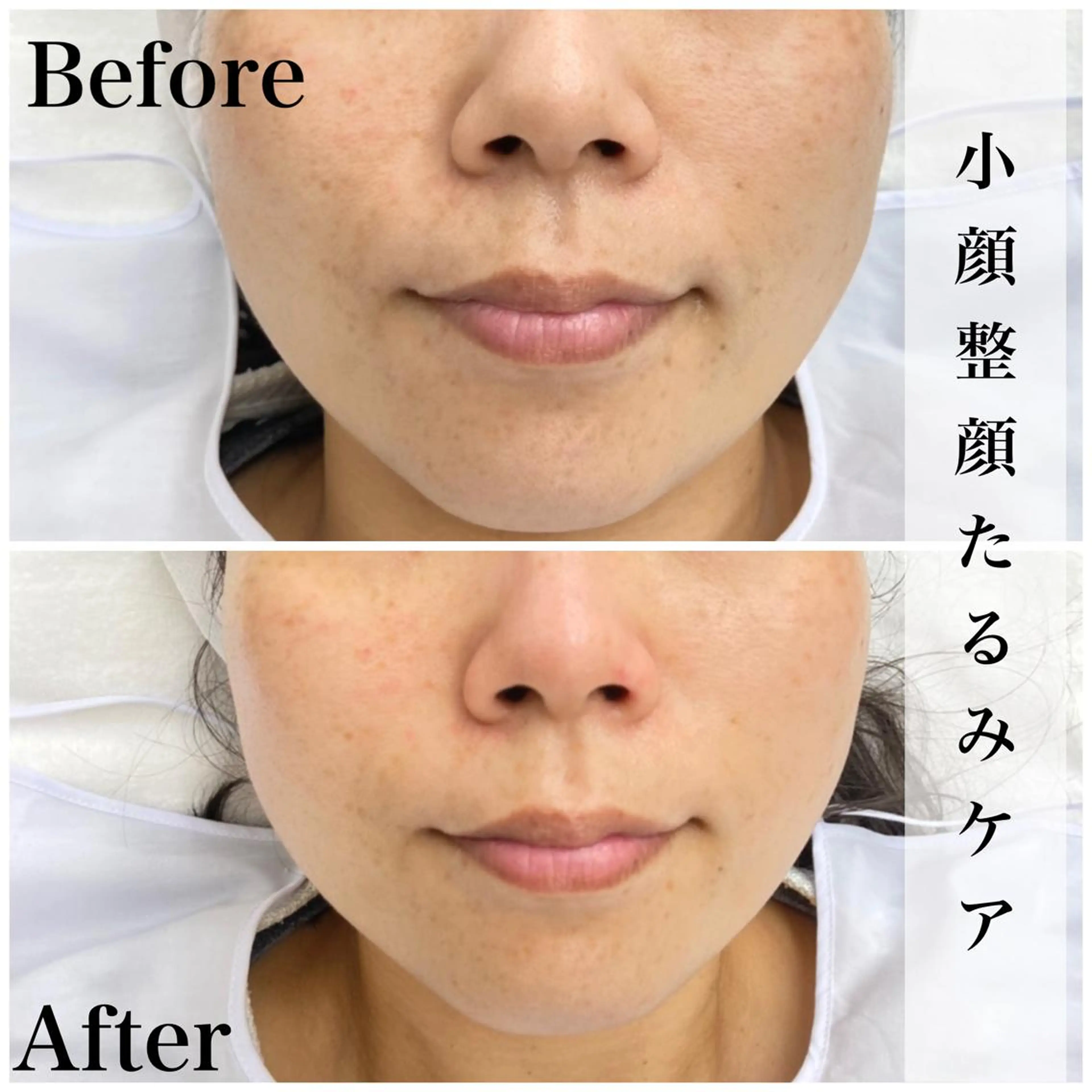 フェイシャルエステFOUATONS＊所属・ﾌｪｲｼｬﾙｴｽﾃ ふわっとんのエステ・リラクイメージ