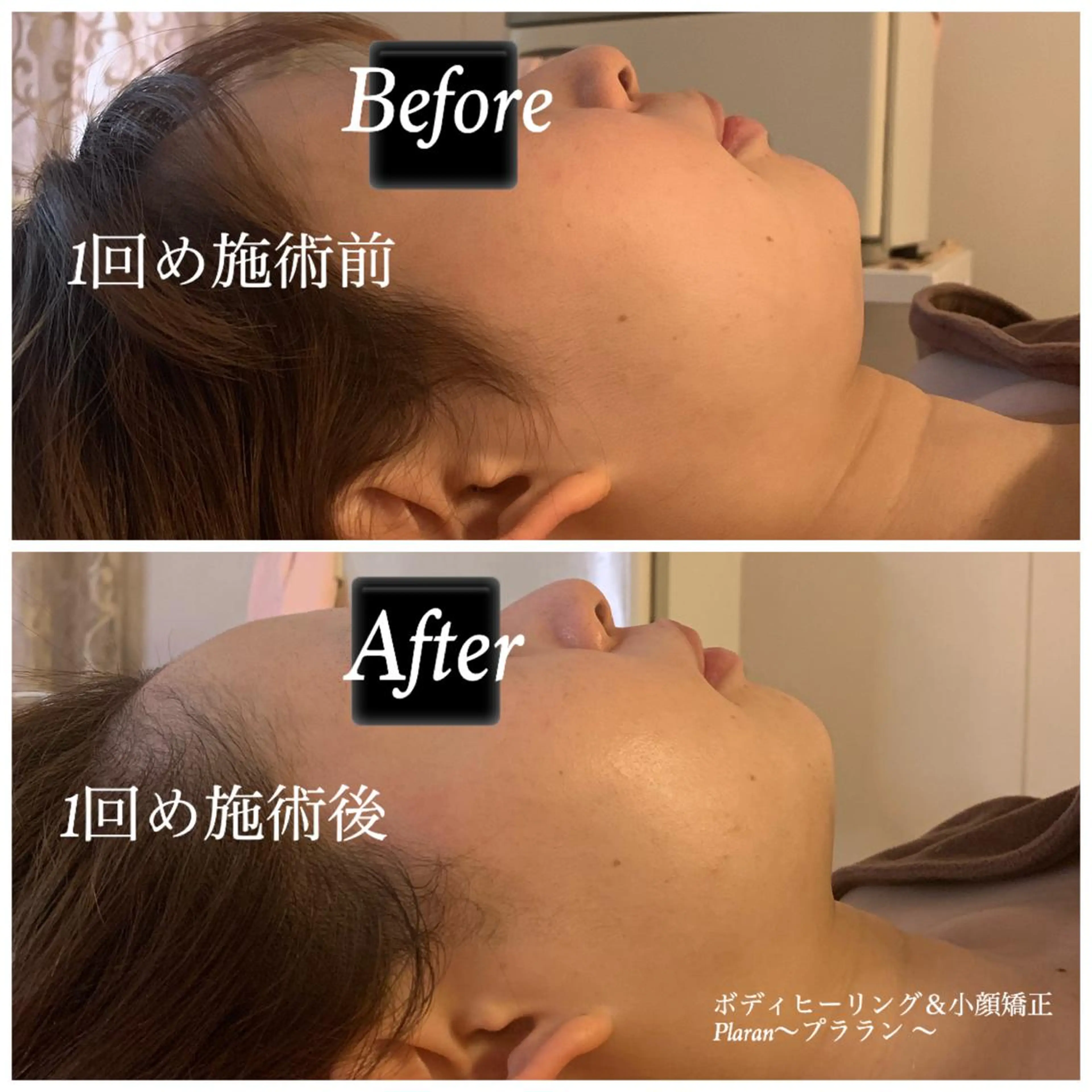 Plaran 〜プララン 〜のその他イメージ