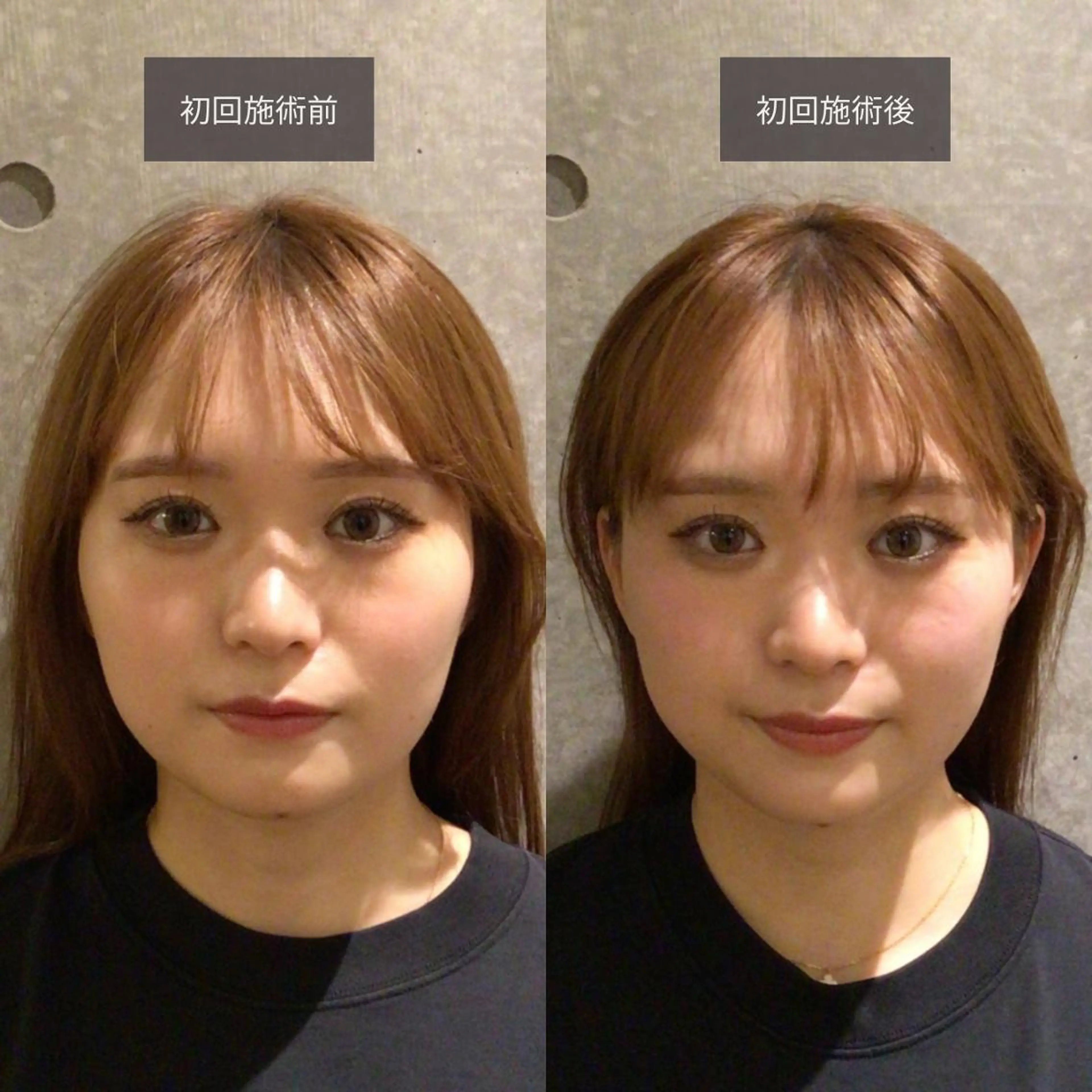 小顔矯正/姿勢矯正 美容整体師　野口杏太のエステ・リラクイメージ