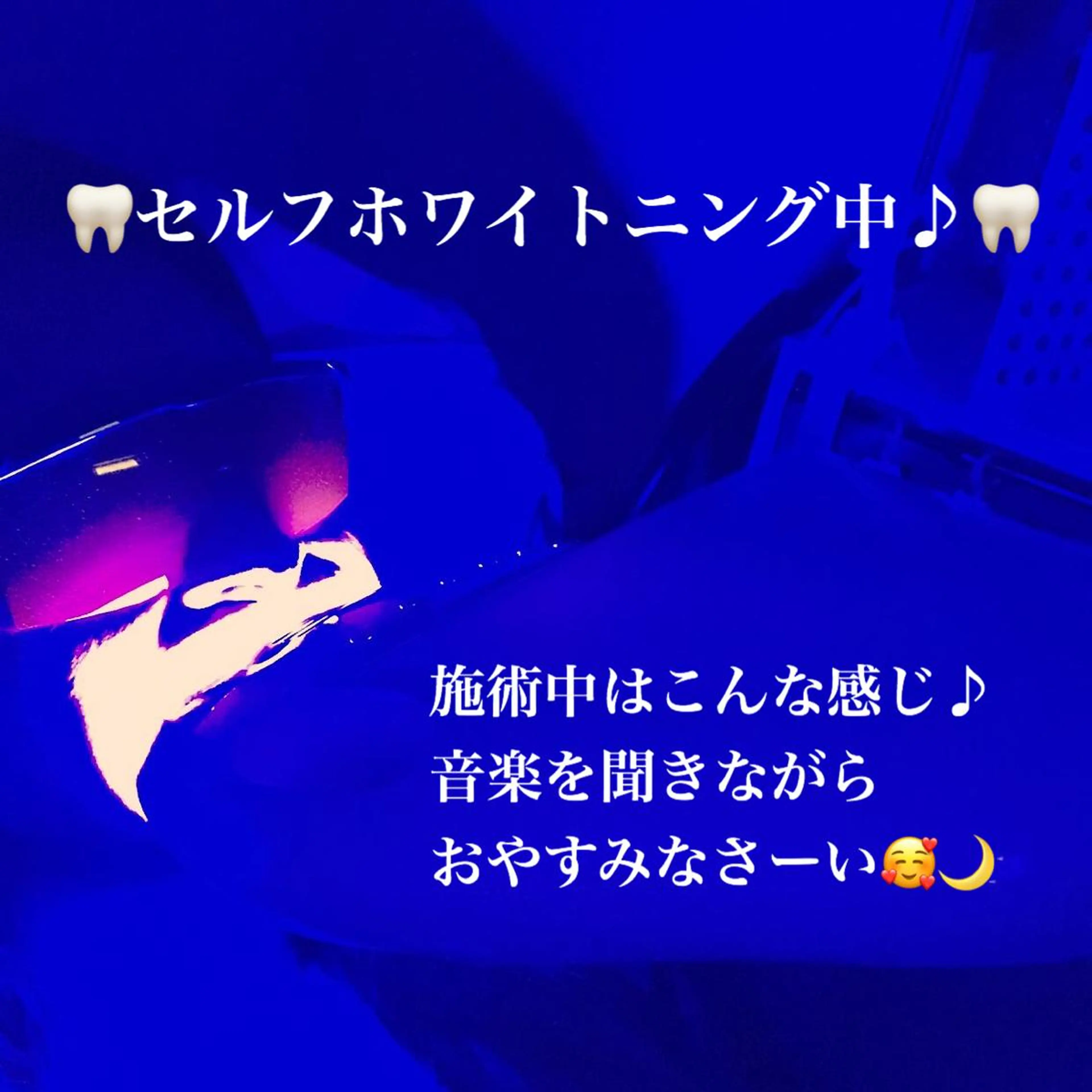 ネイル/耳つぼ /新ホワイトニングのネイルデザイン