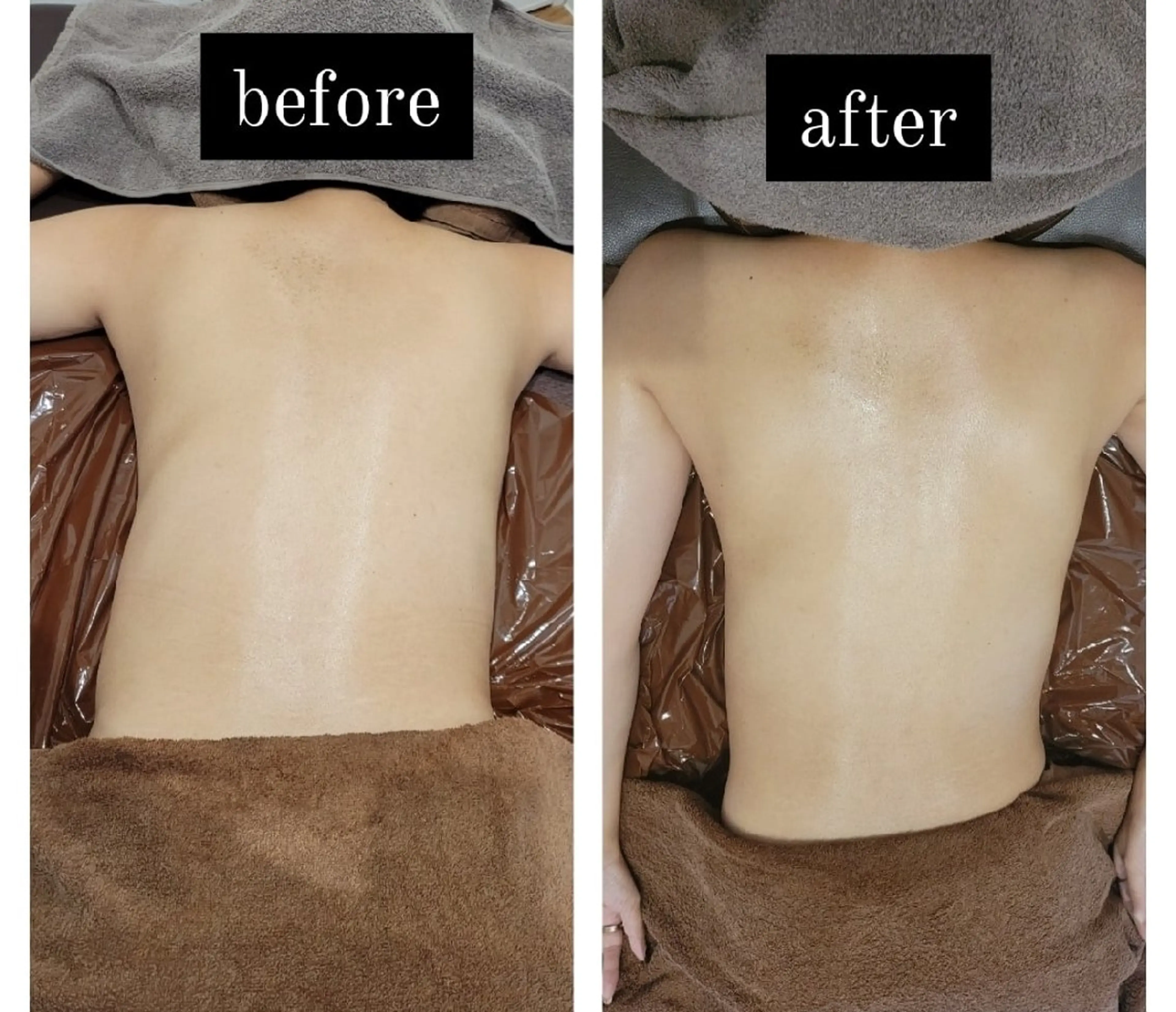 オイルトリートメントお試し40分【背面のみ】の写真