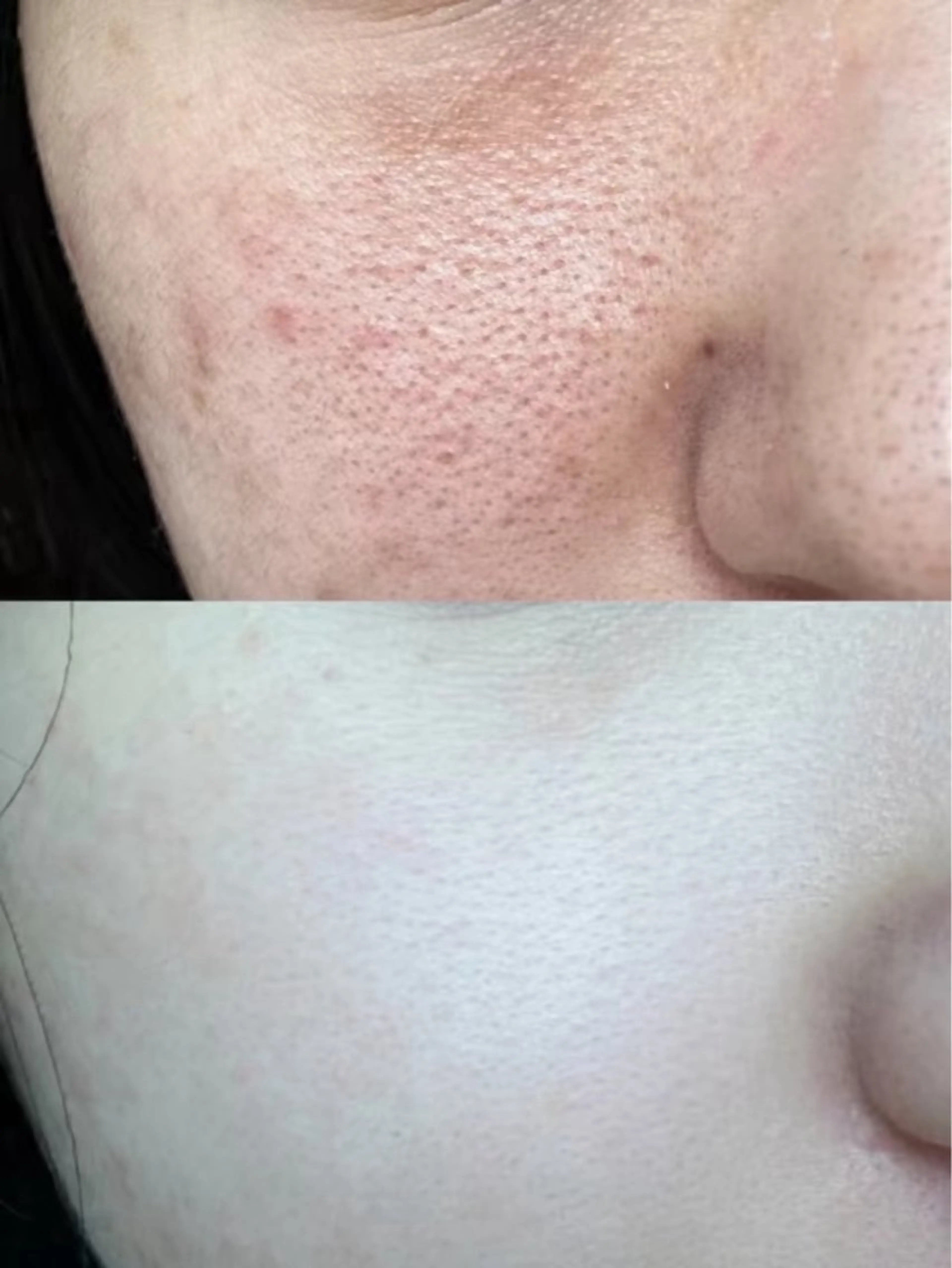 ネイル エステ aliaハイフ&水光ジェットサロン所属・aliaハーブ水光店 エステティシャン募集のエステ・リラクイメージ