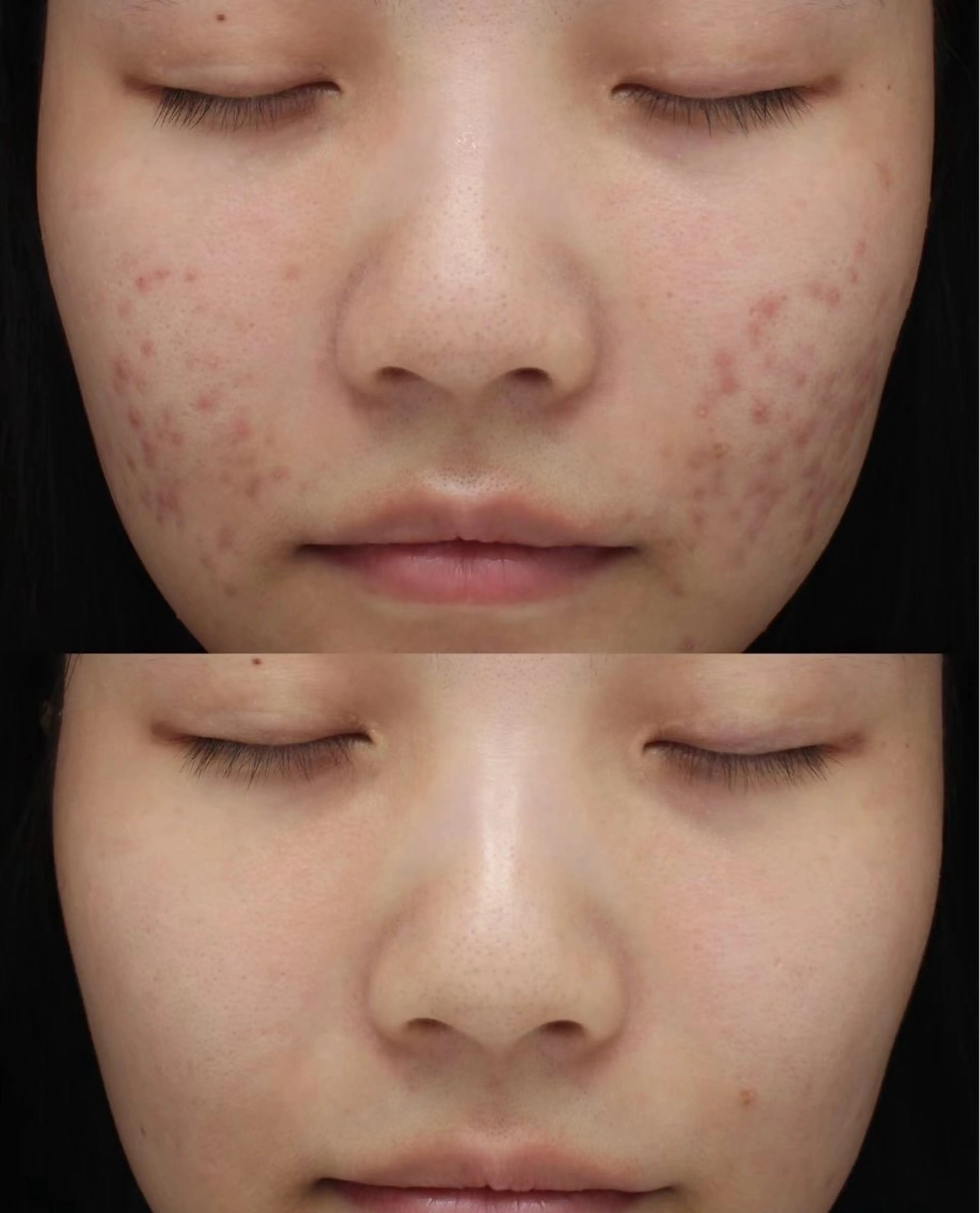 ネイル エステ aliaハイフ&水光ジェットサロン所属・aliaハーブ水光店 エステティシャン募集のエステ・リラクイメージ