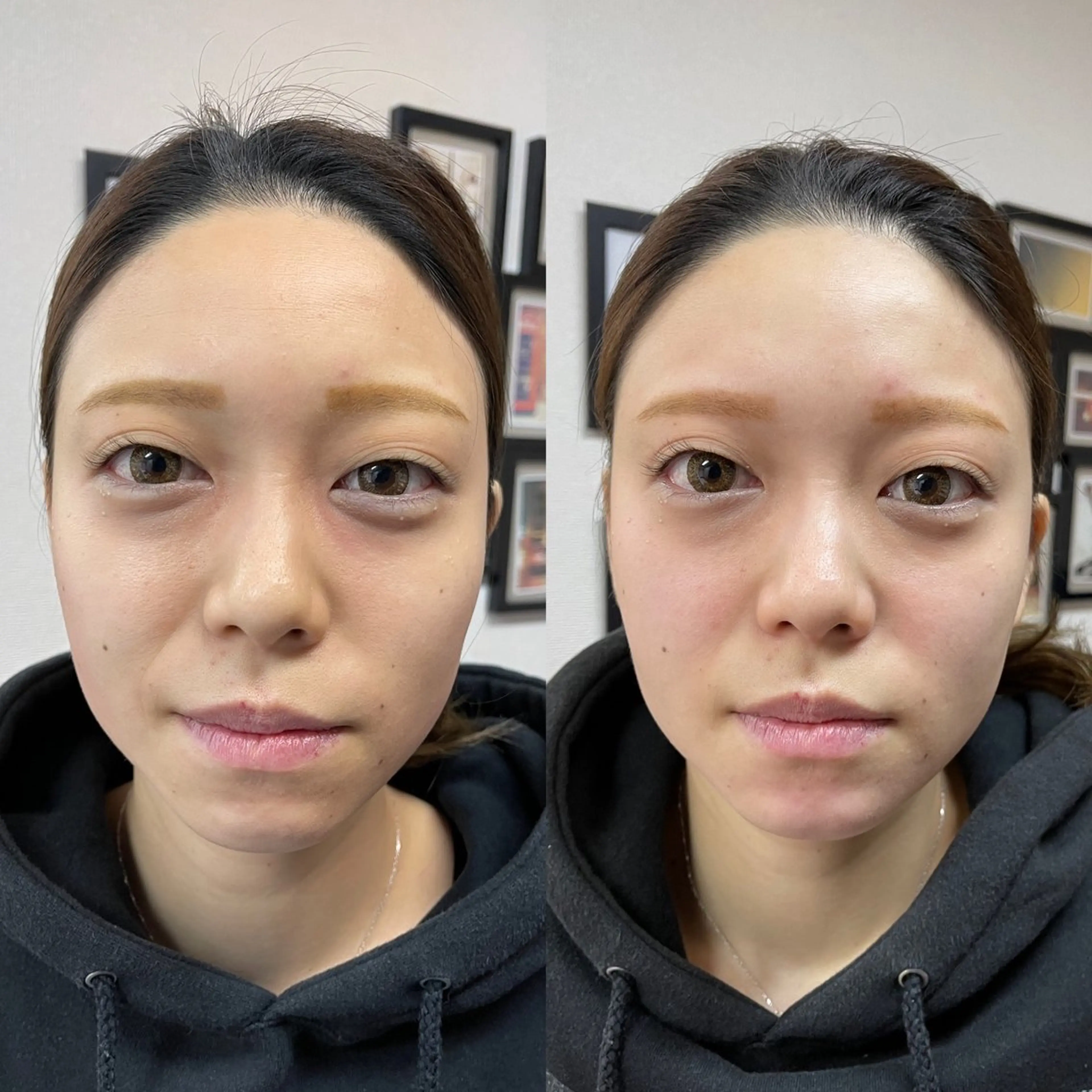 ⭐️美容小顔調整⭐️の写真