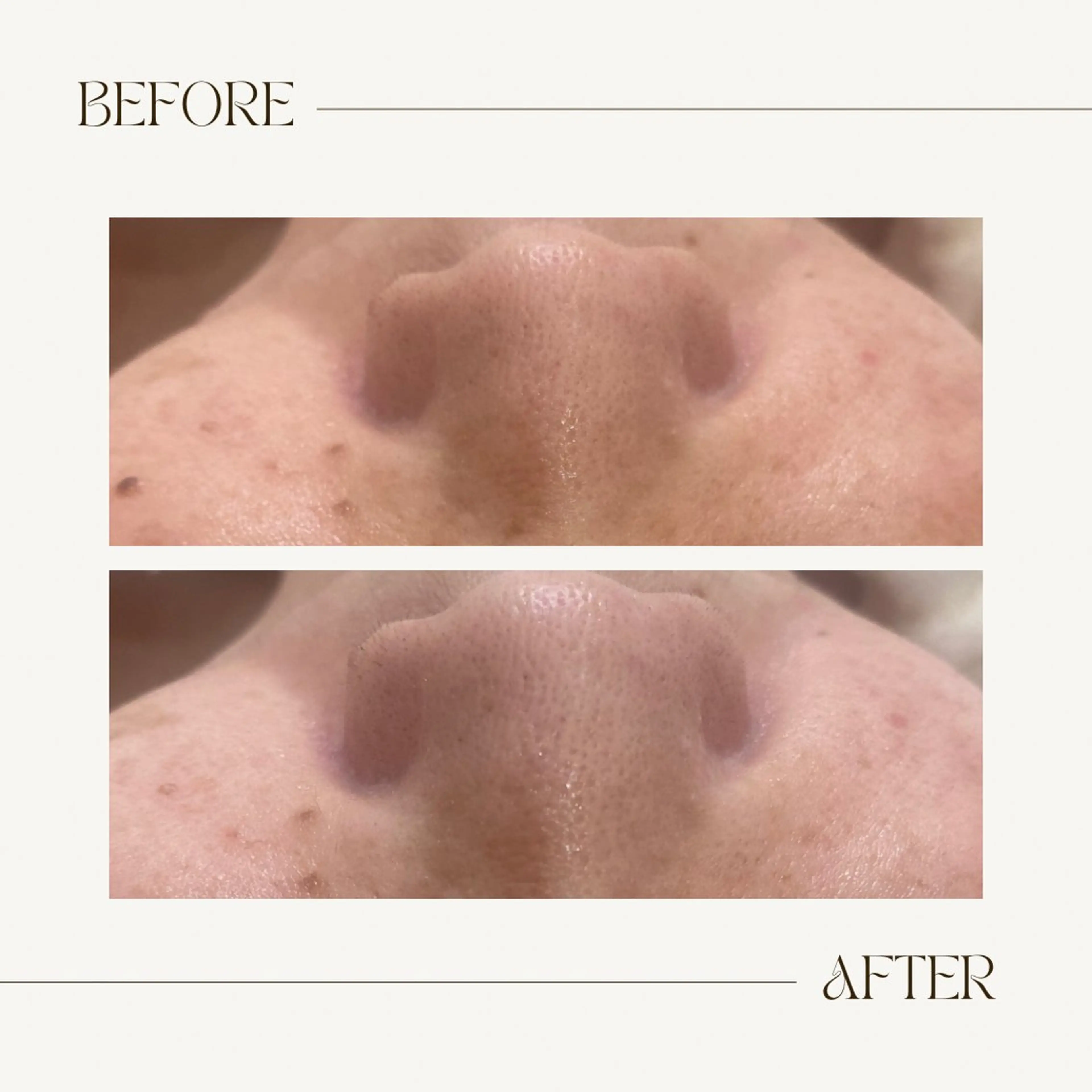 CEsalonEgg 齋藤のエステ・リラクイメージ