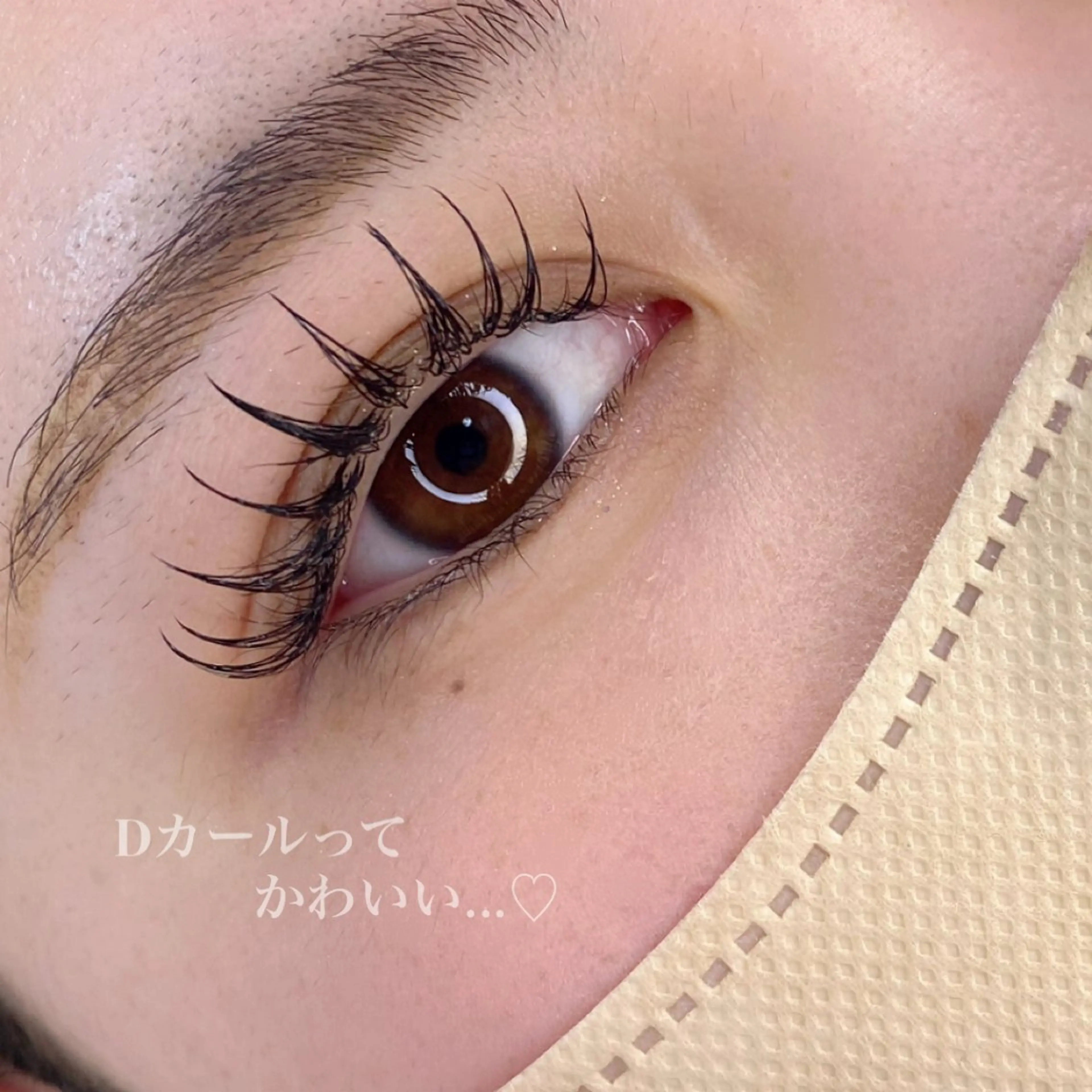 【フラットラッシュ】　140本の写真