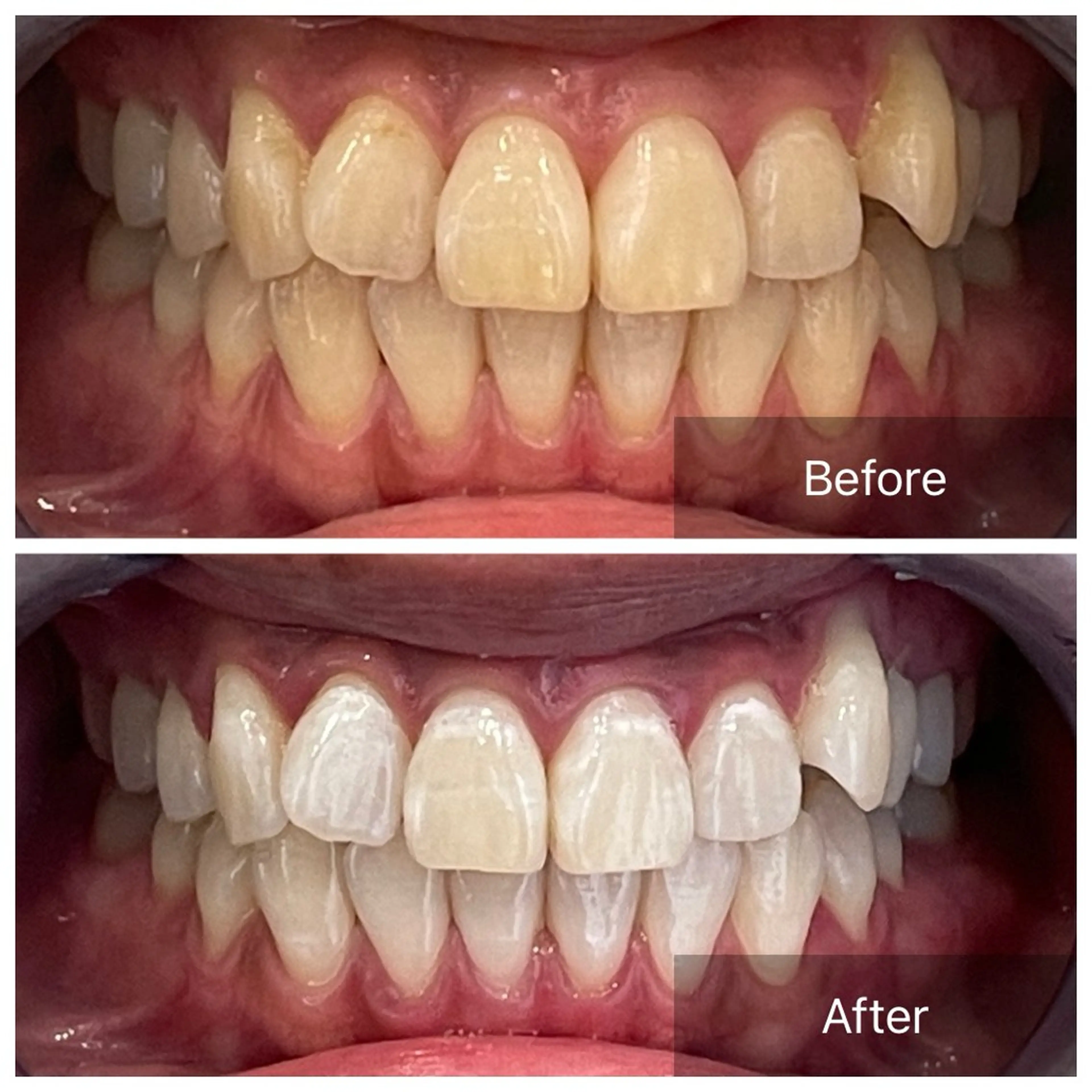 その他 ホワイトニングサロンライエ所属・岡本 由香理のその他イメージ
