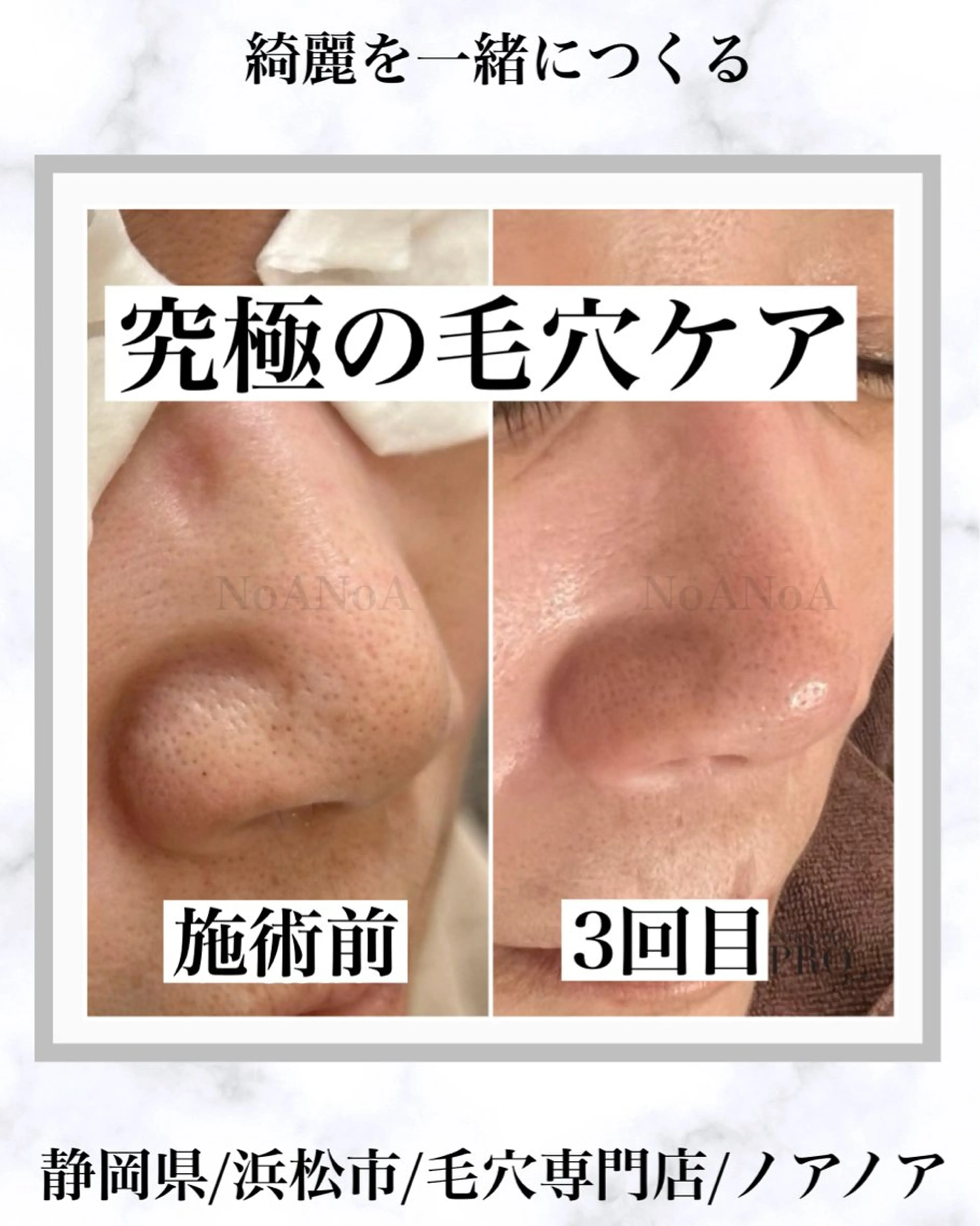 エステ NoANoA Naguraの眉毛・アイブロウイメージ