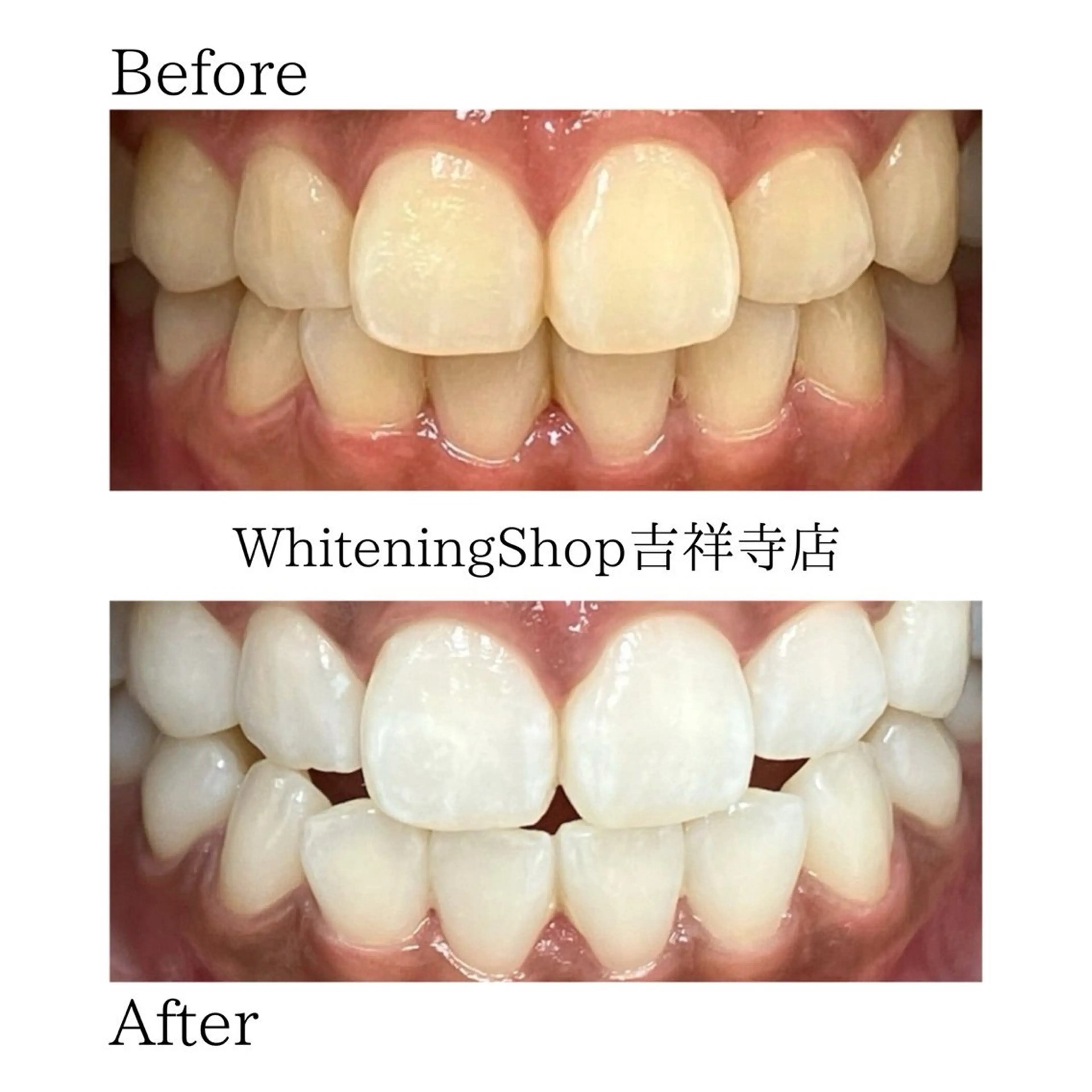 ホワイトニングショッ 吉祥寺2号店のエステ・リラクイメージ