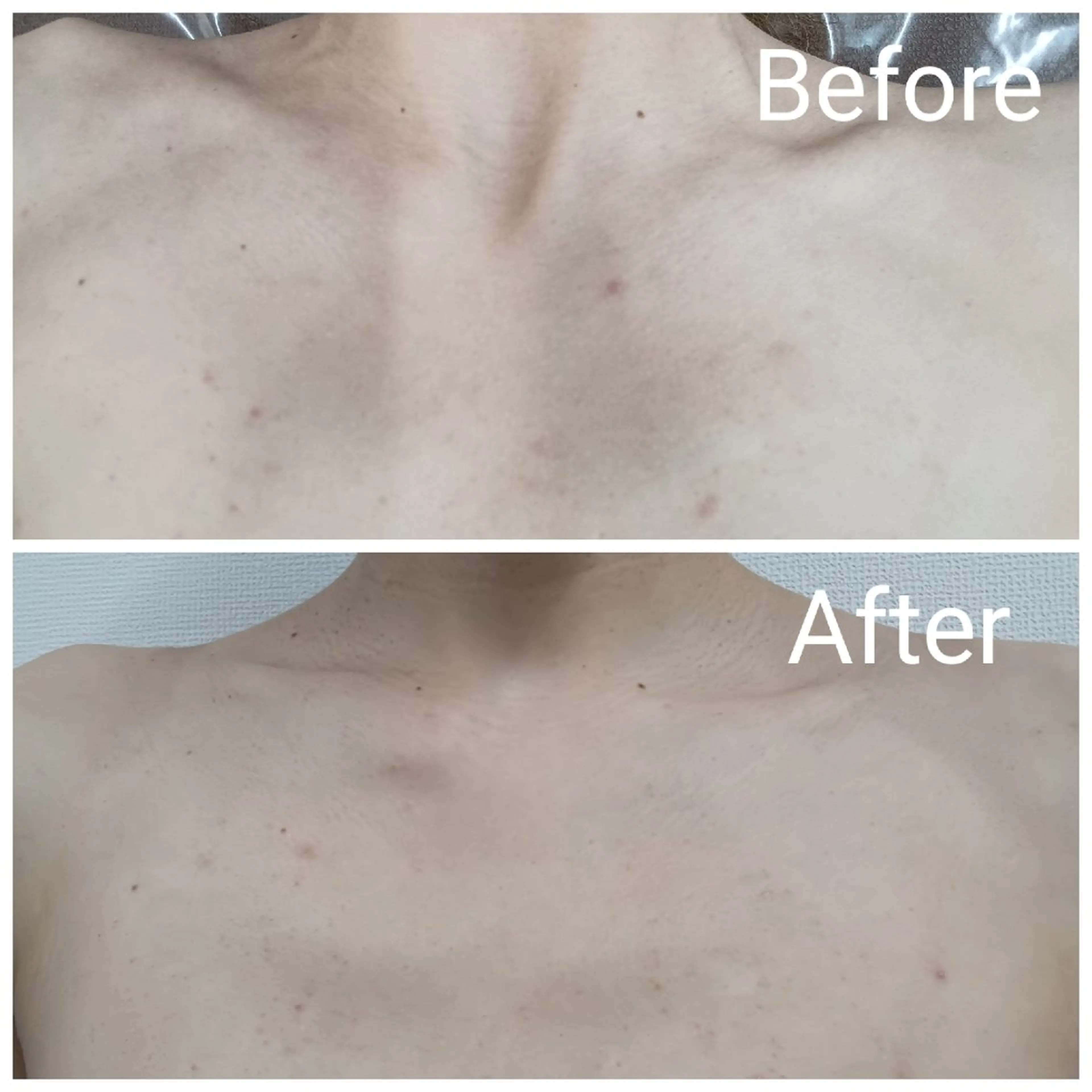 エステ リラク 肌質改善Beauty salon Renのエステ・リラクイメージ