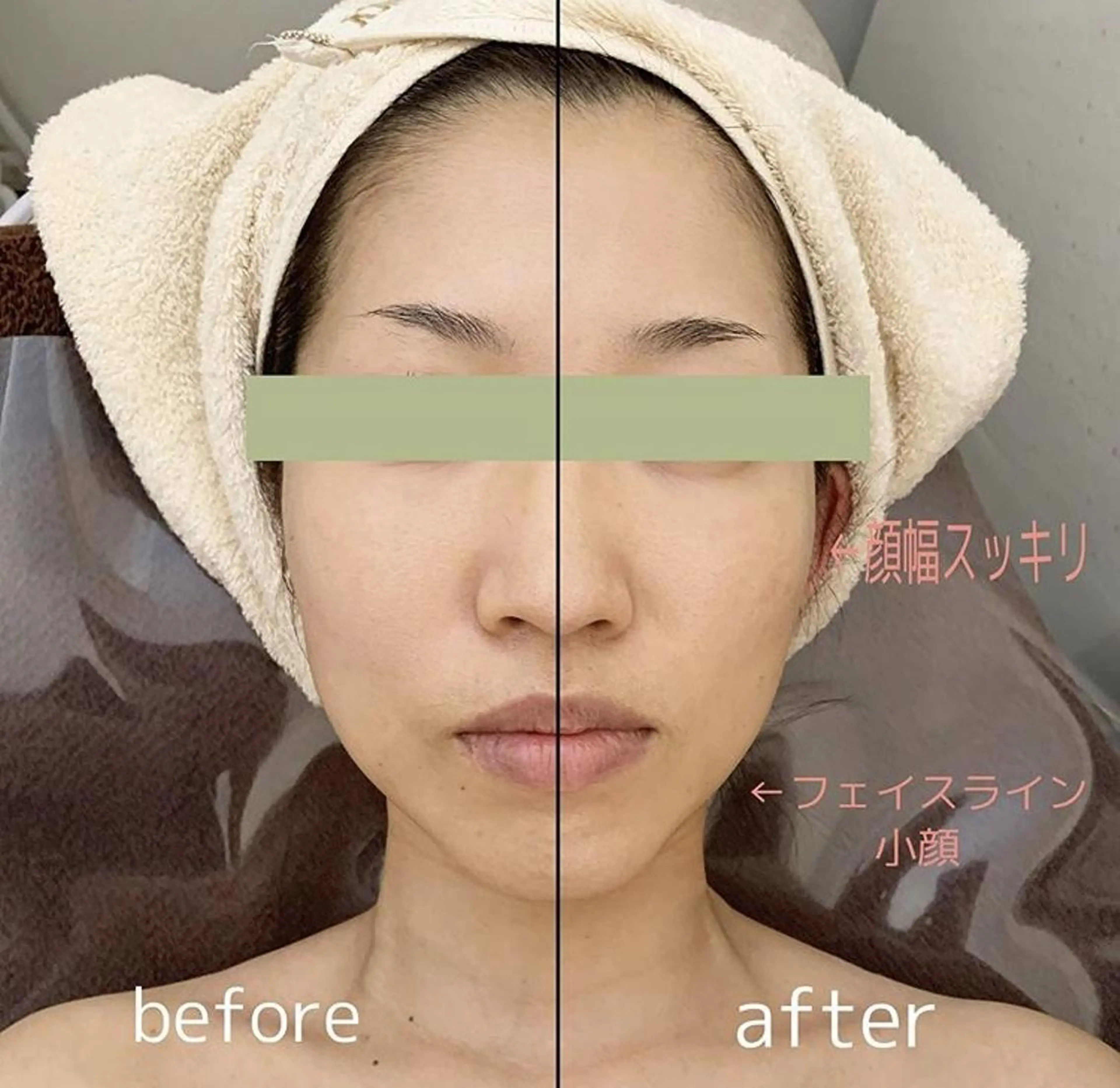 OPREA 栄店のエステ・リラクイメージ