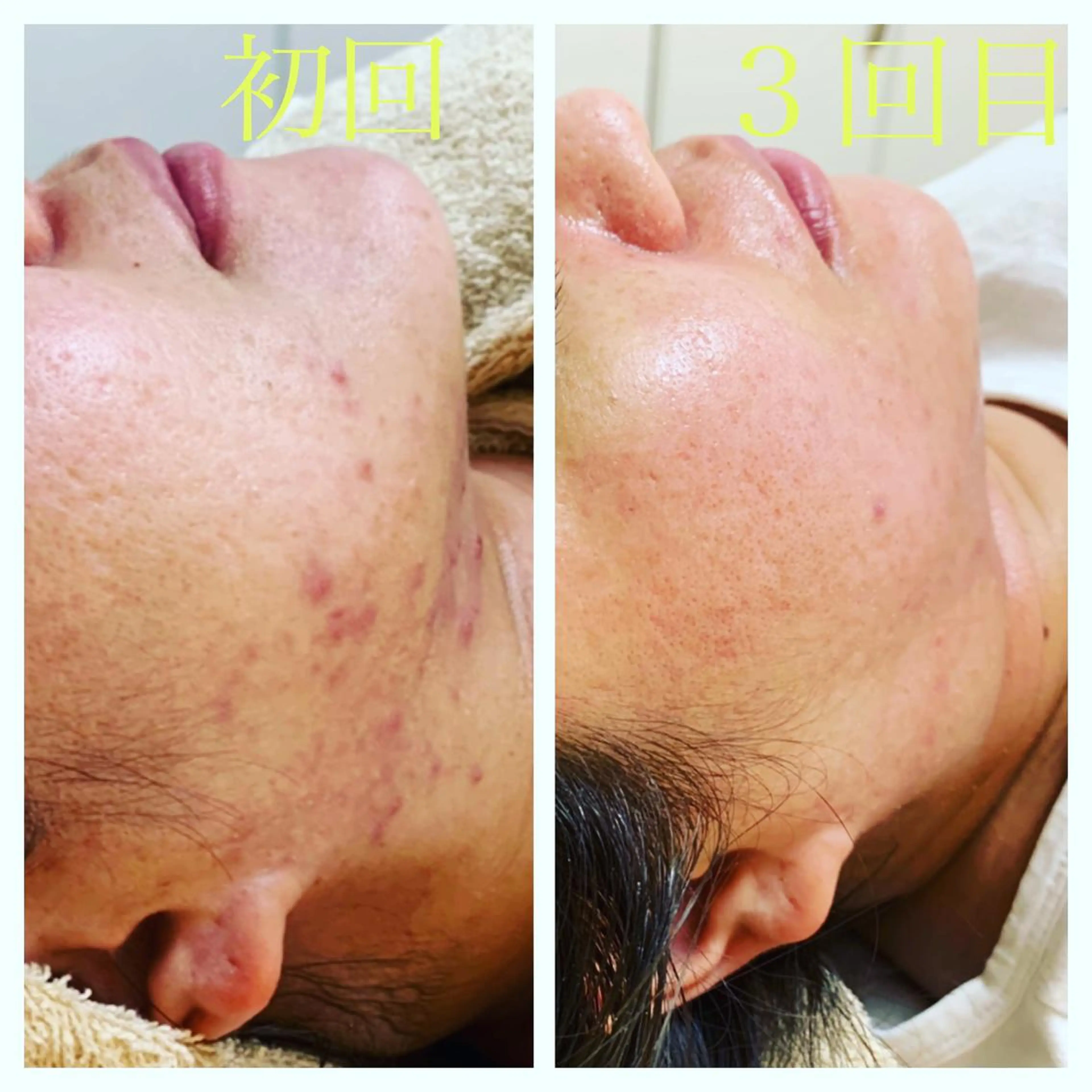 エステ リラク エステティック Nanagiのエステ・リラクイメージ