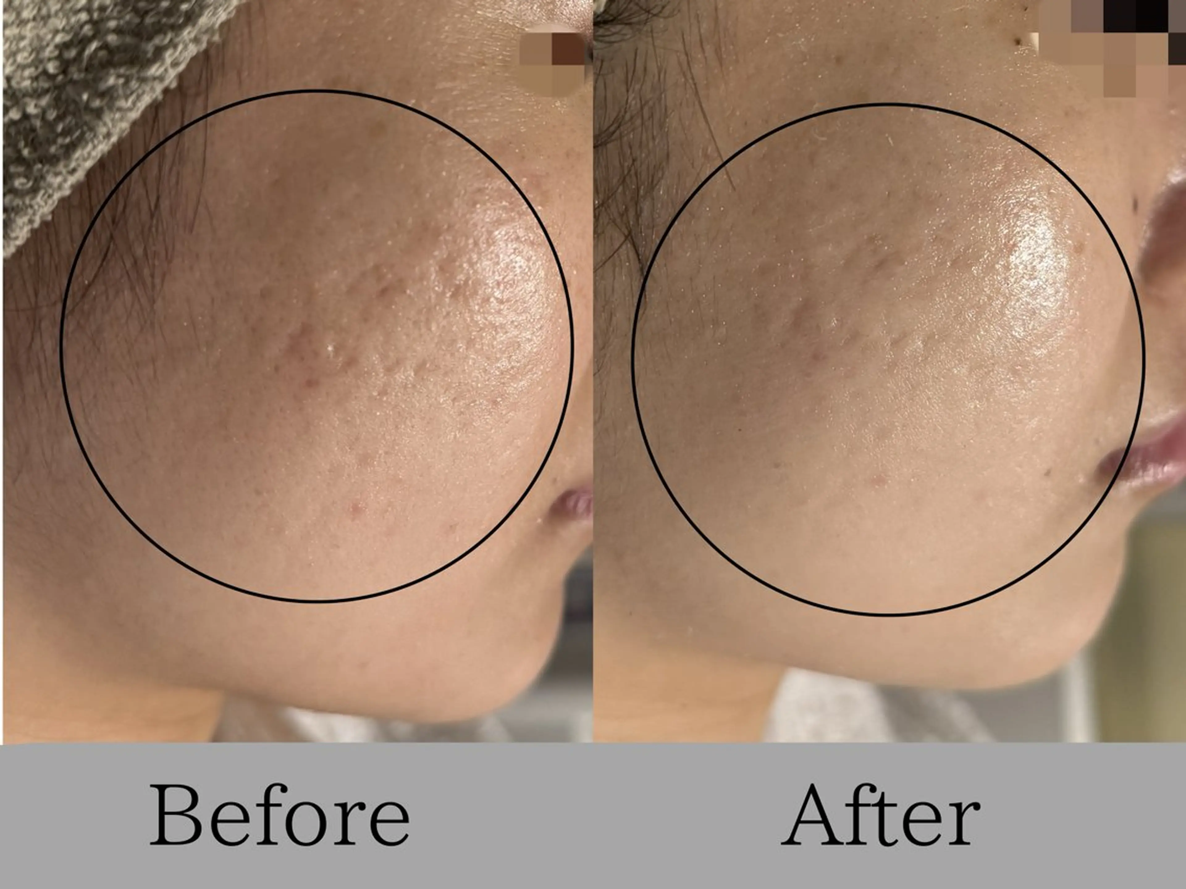 エステ リラク lumirise所属・lumi riseのエステ・リラクイメージ