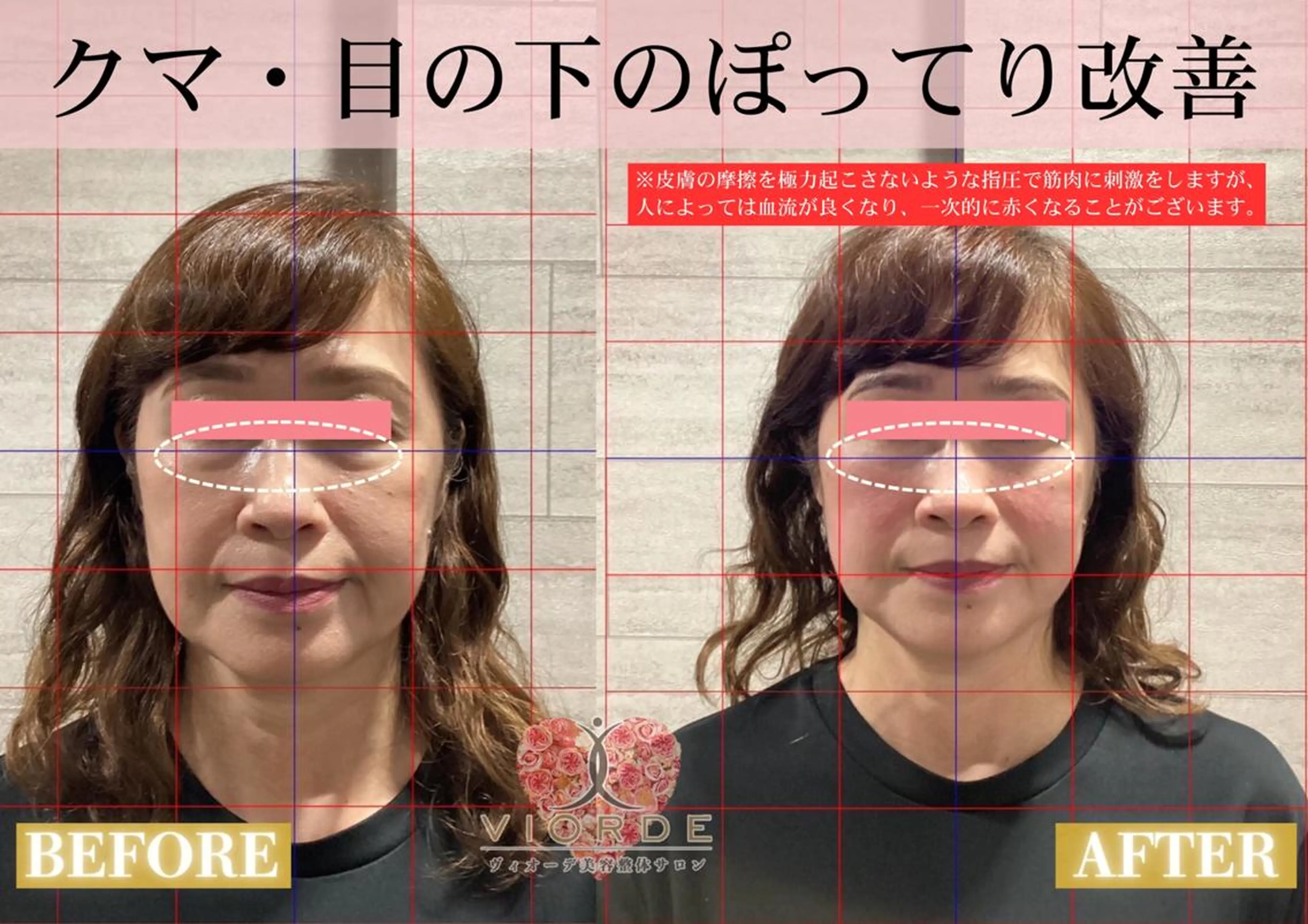 リラク ヴィオーデ美容整体 サロン 二子玉川店のエステ・リラクイメージ