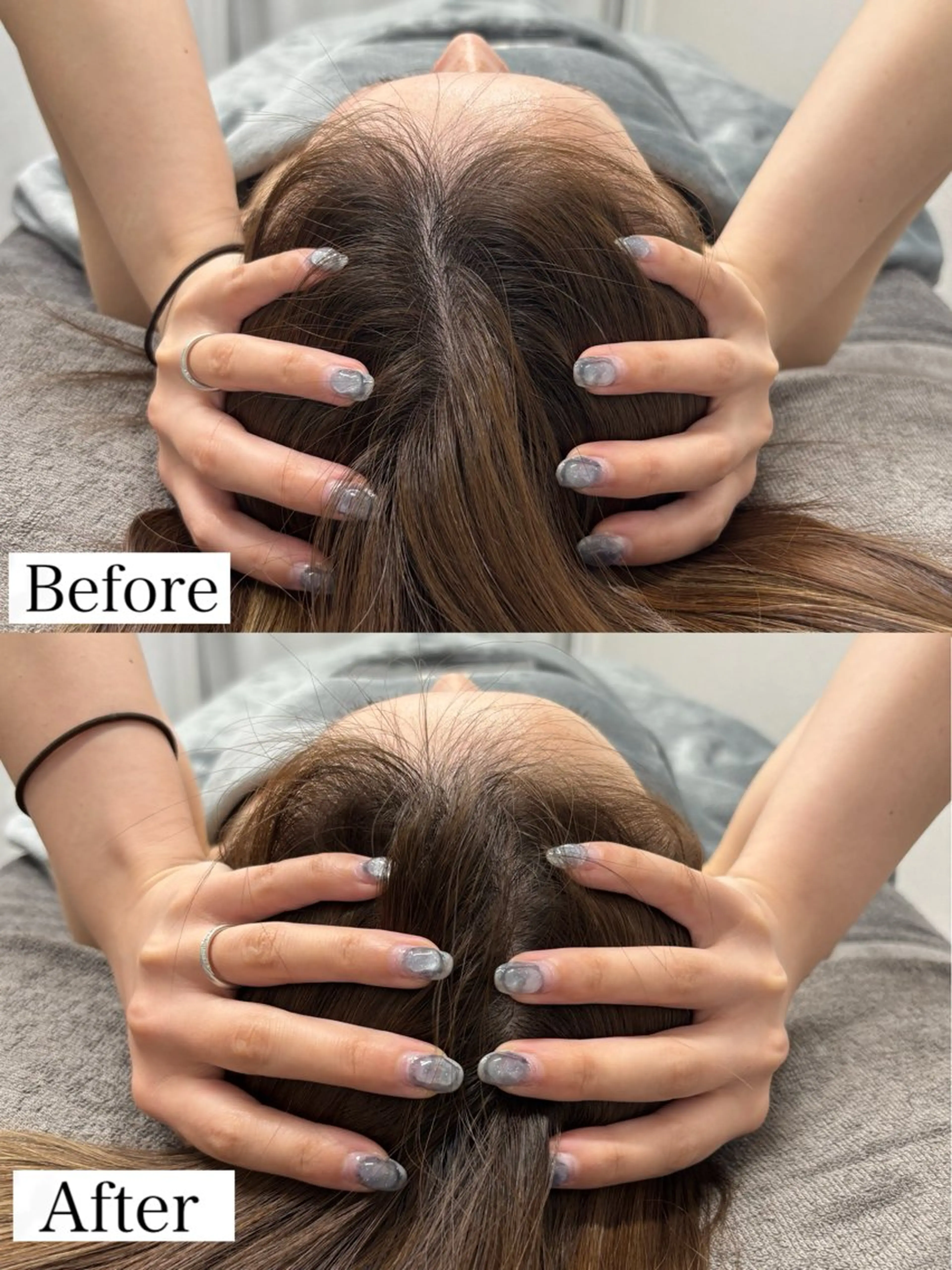 エステ リラク Linoas所属・kogao&head Linoasのその他イメージ