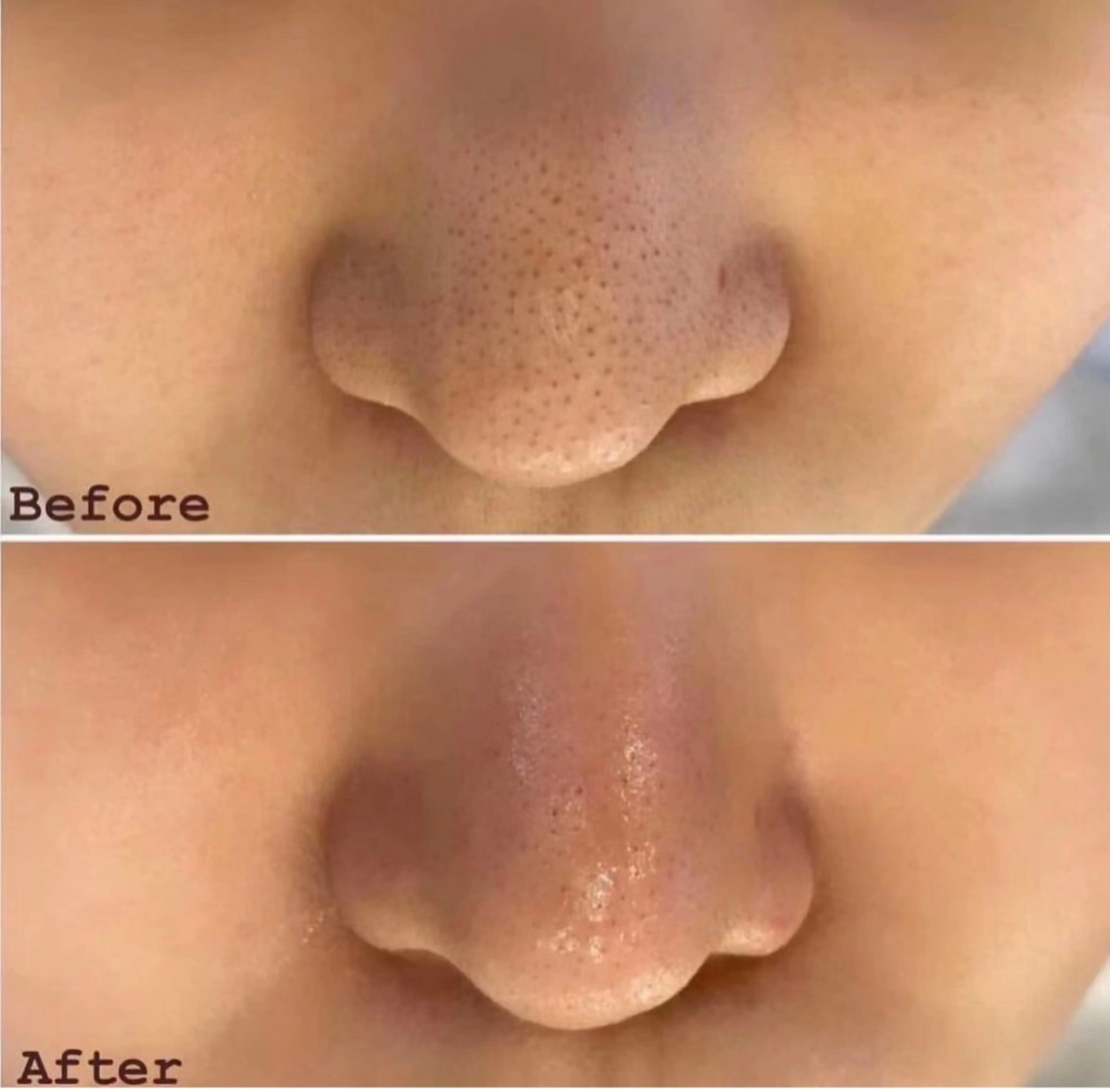 全身スッキリアロマリンパ+小顔コルギ+毛穴洗浄+デコルテ+ヘッドスパ120分の写真