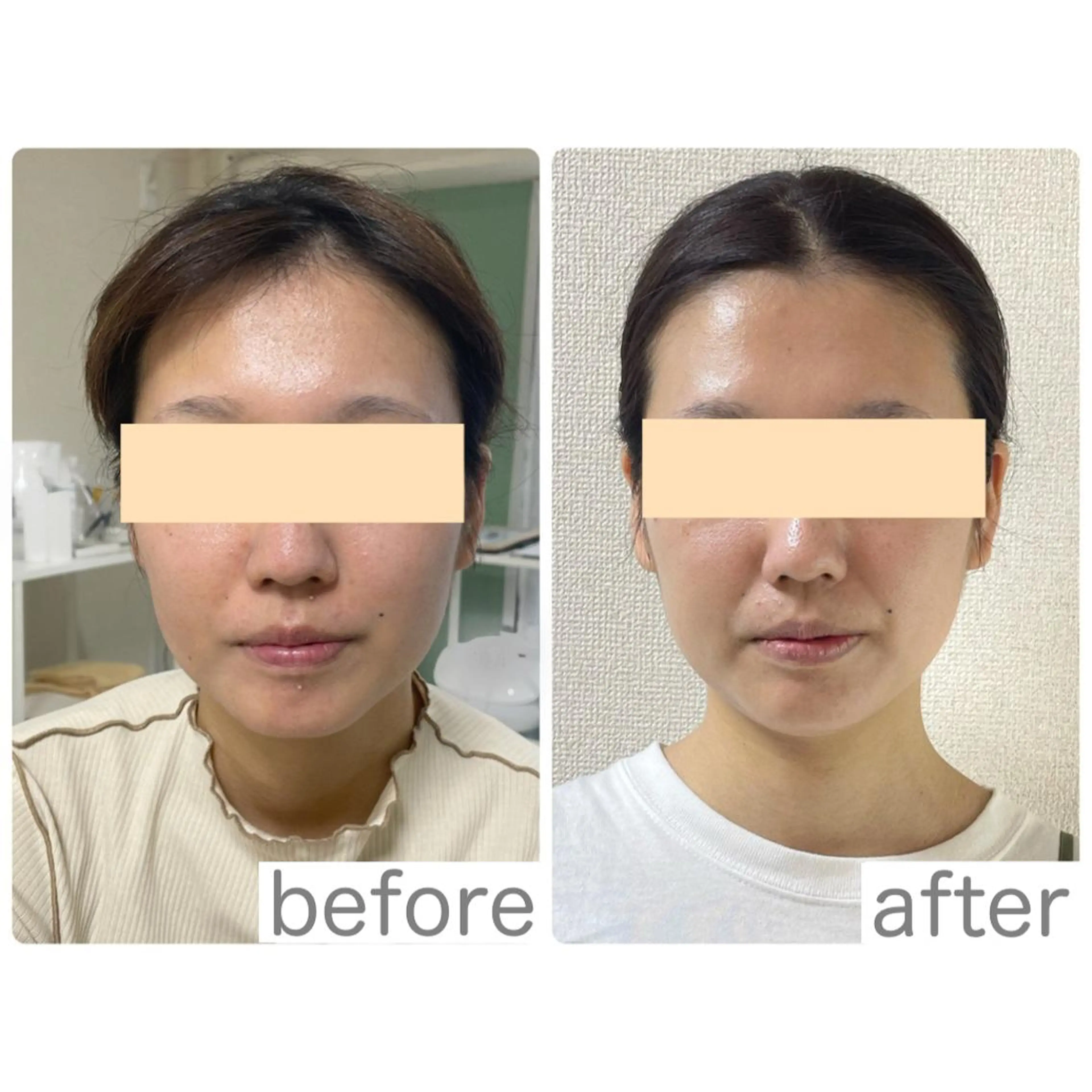 小顔矯正サロン　クレール所属・小顔矯正専門サロン クレールのエステ・リラクイメージ