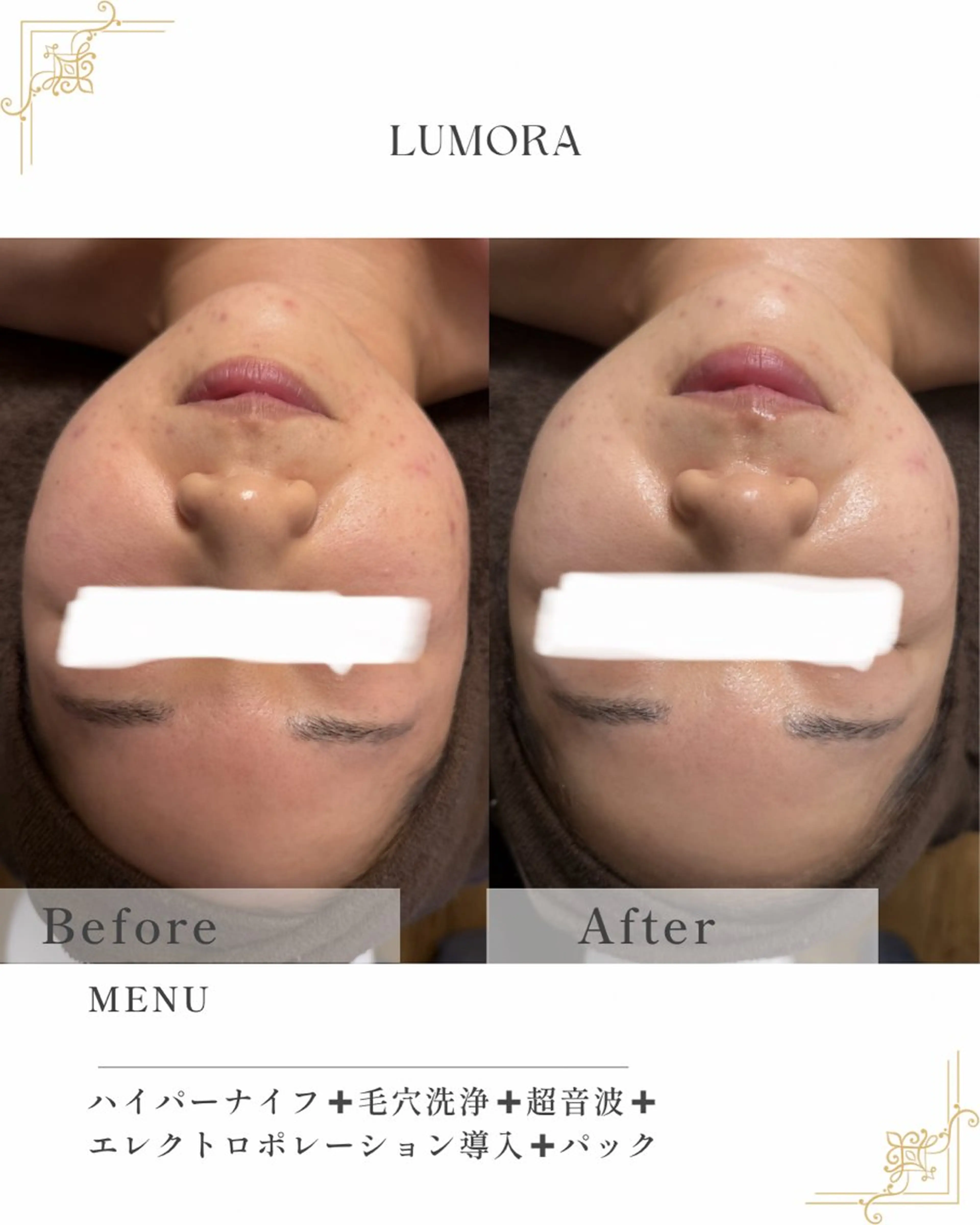 エステ リラク TOTAL BEAUTYSALON LUMORA所属・LUMORA🌟 トータルビューティーのエステ・リラクイメージ