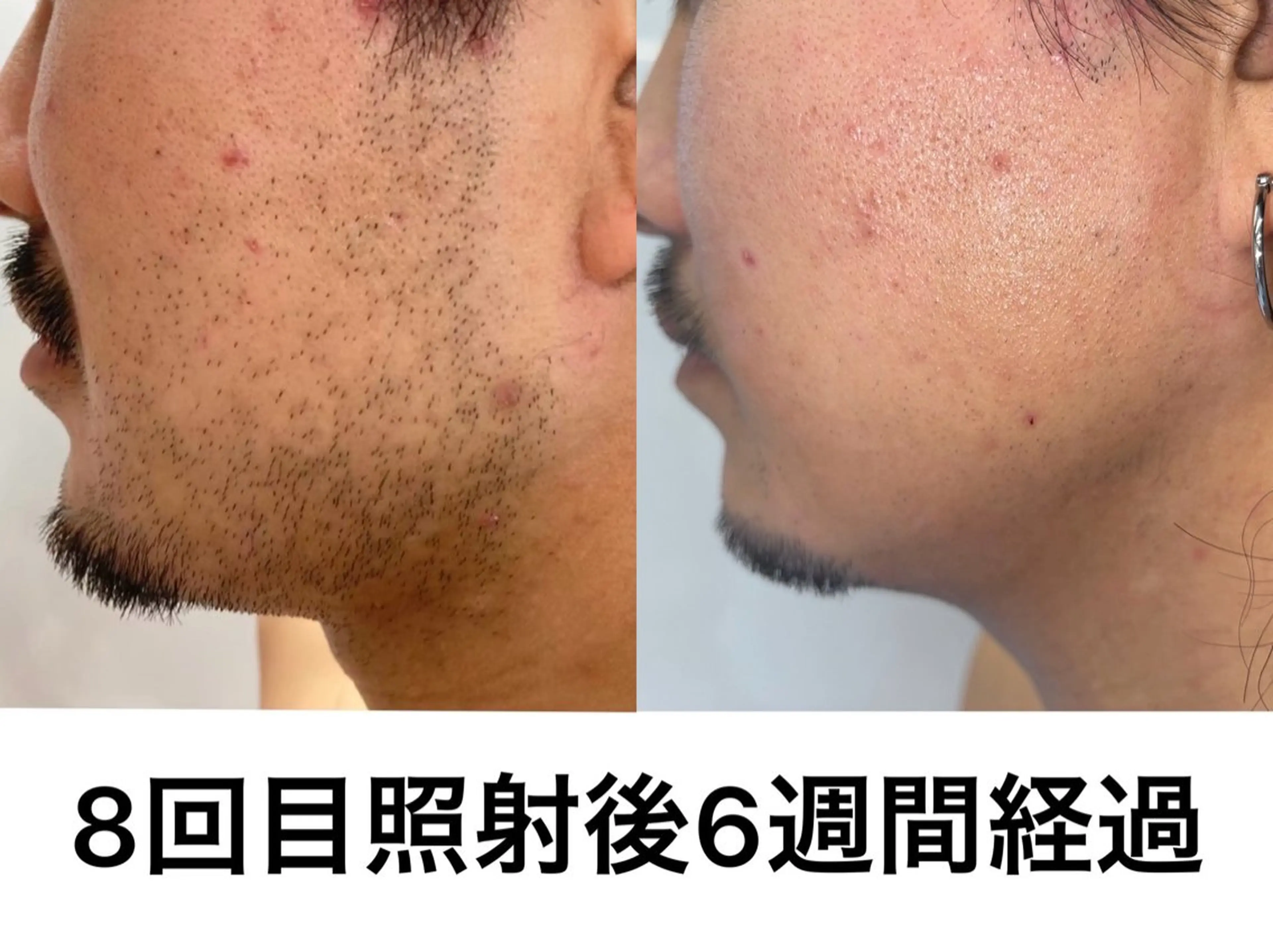 メンズ 佐田 優華のマツエク・マツパデザイン