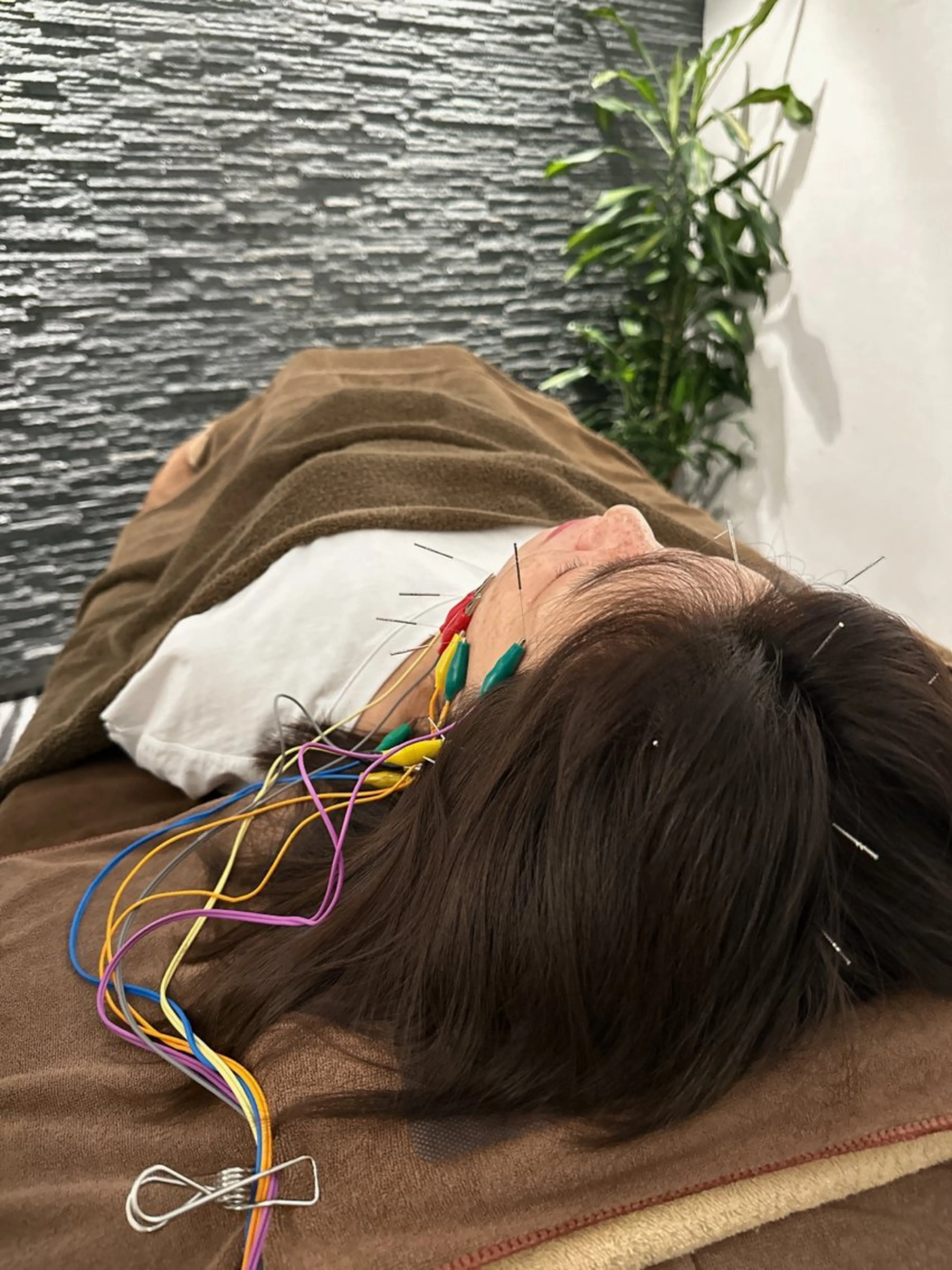 その他 美容鍼灸整体サロンBeauJu所属・小顔矯/美容鍼/鍼灸 BeauJuのその他イメージ