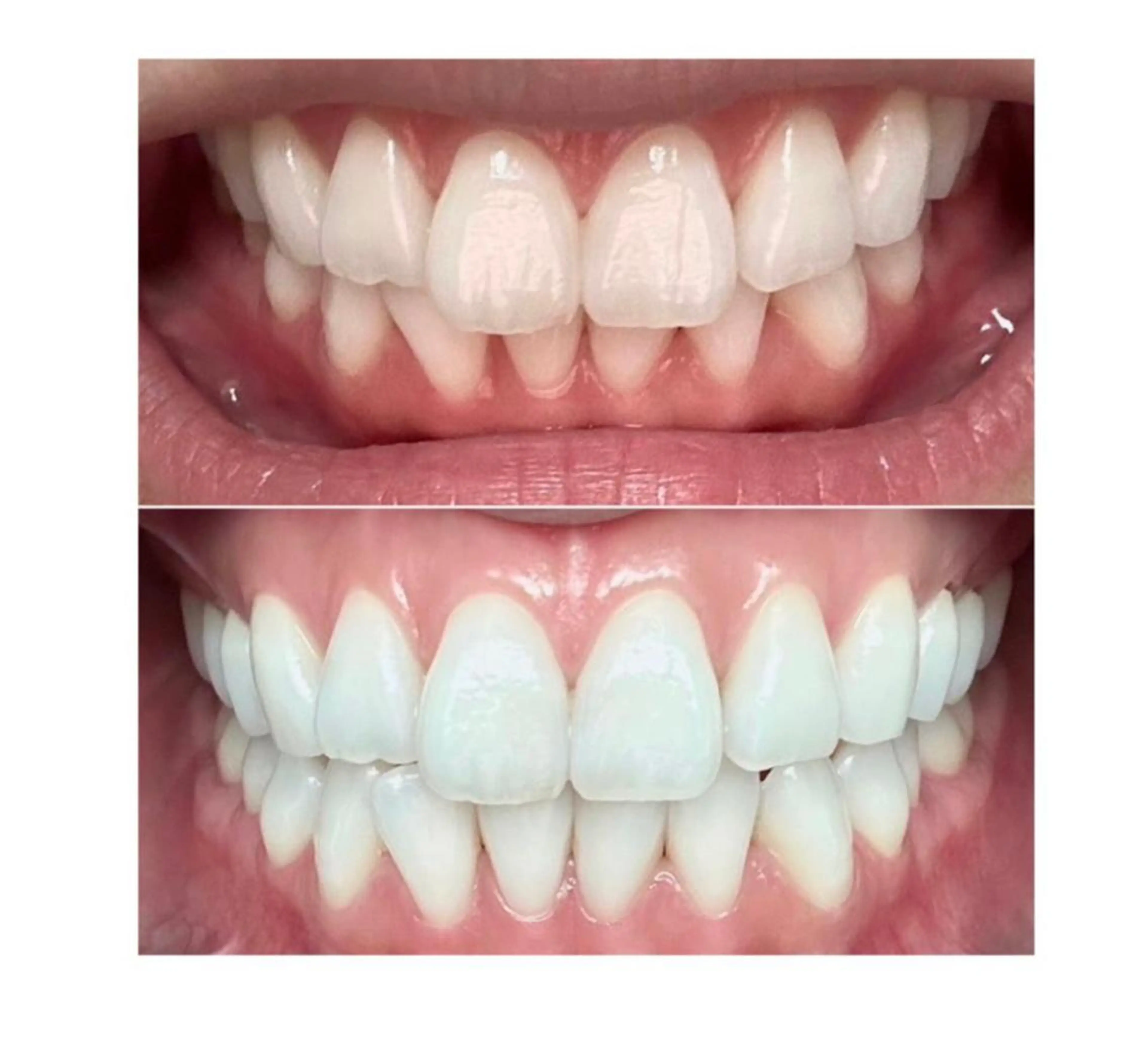 その他 ホワイトニングジム 池袋のその他イメージ