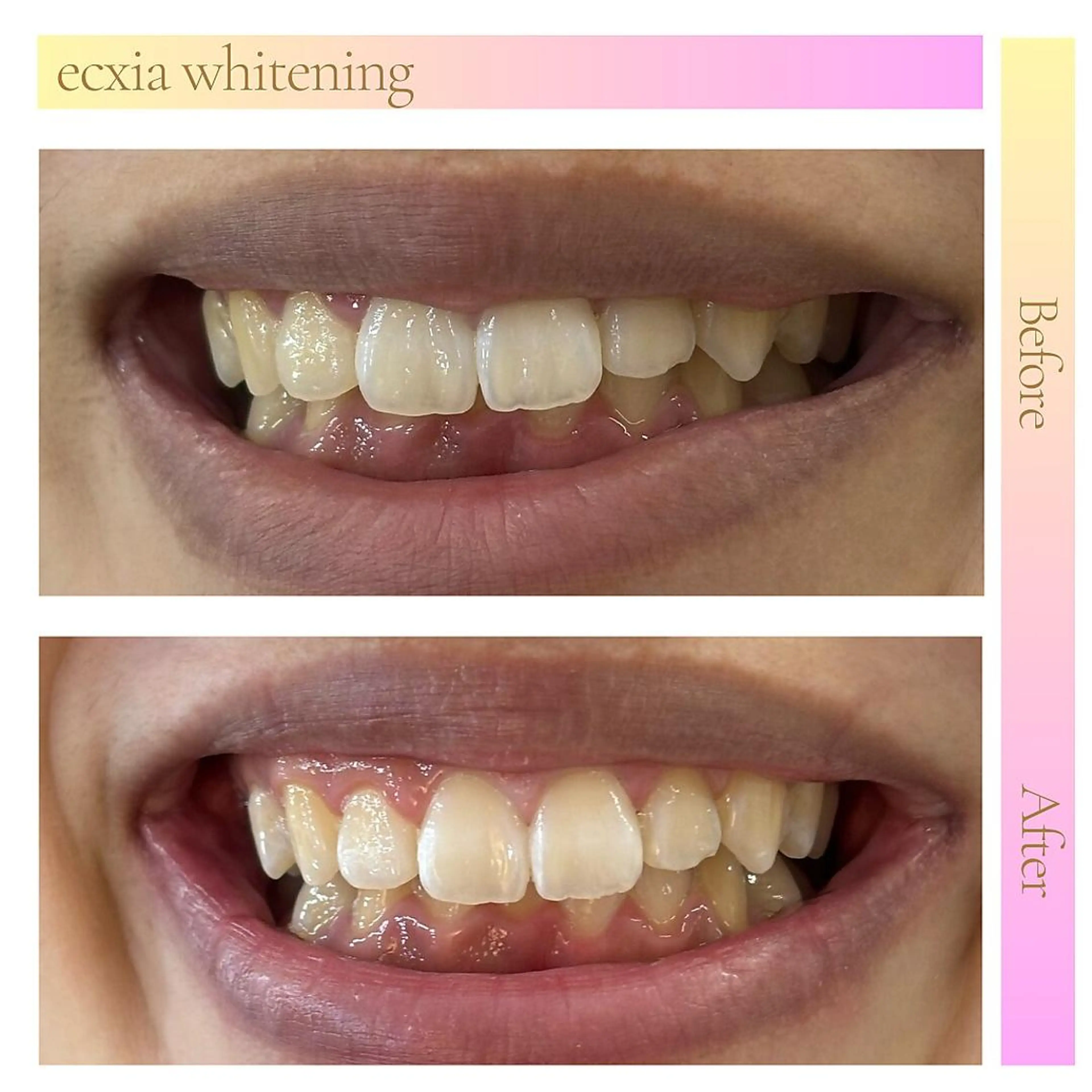 その他 セルフホワイトニング エクシア 京都四条店のその他イメージ