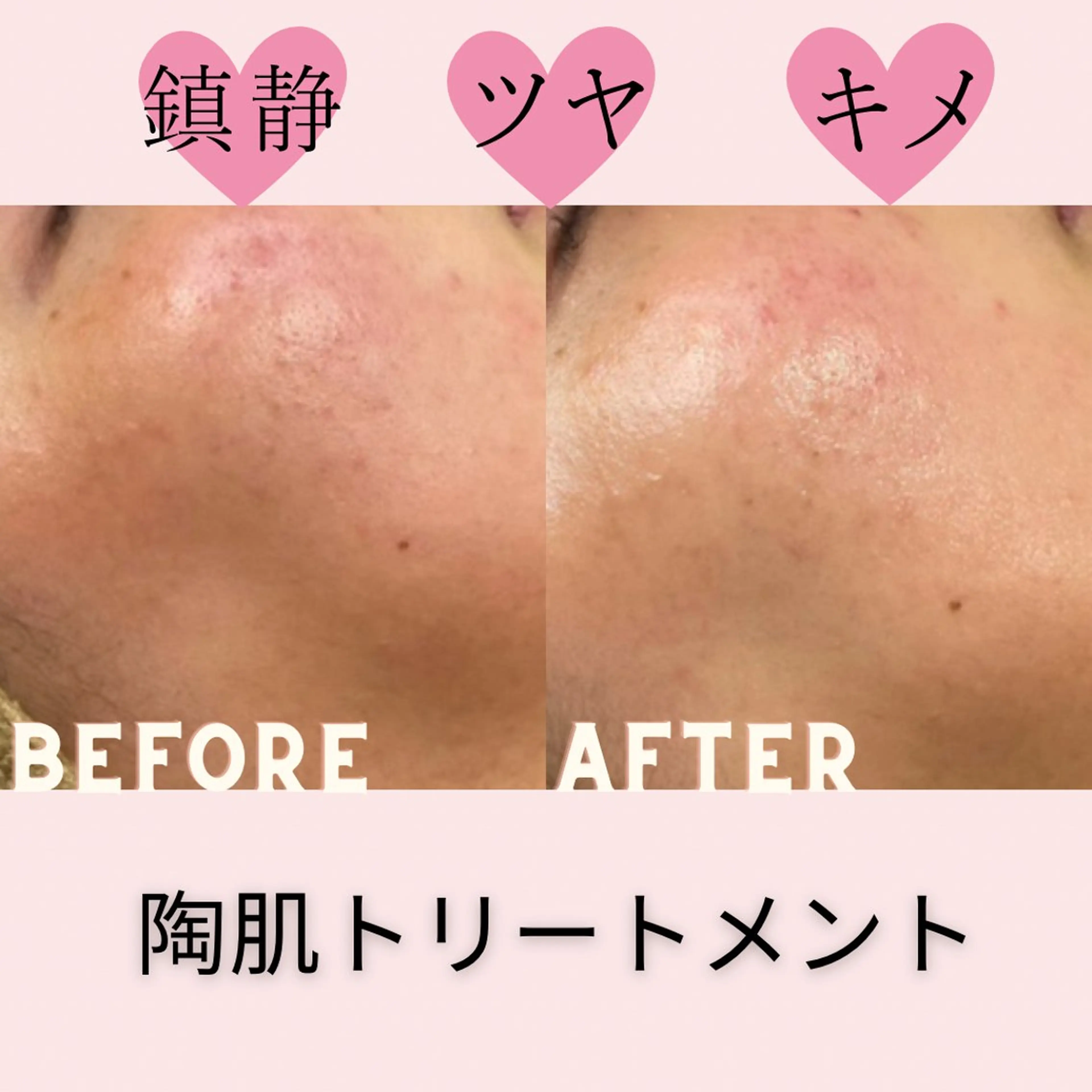 エステ amber(アンバー)所属・プライベートサロン amberのエステ・リラクイメージ