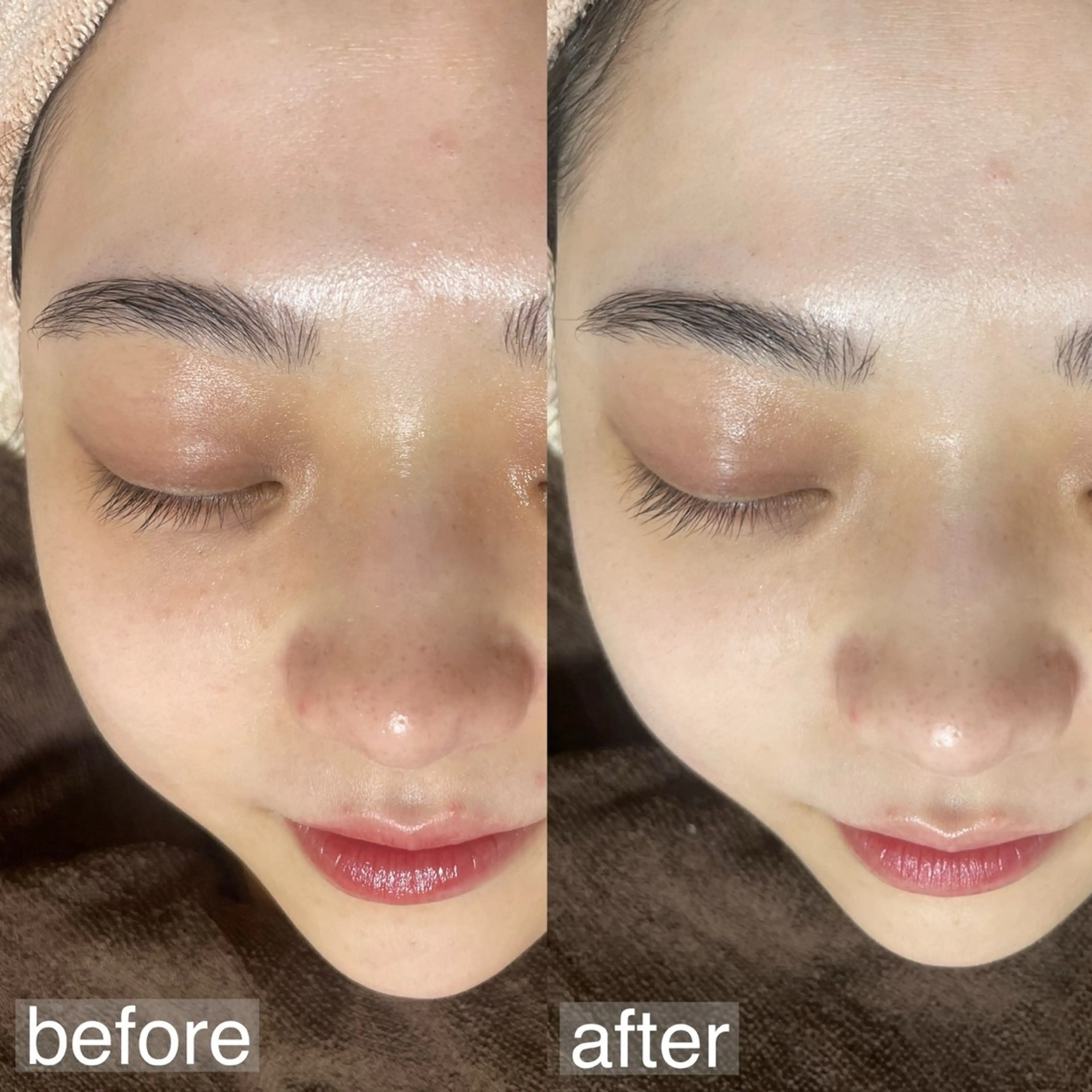 アイブロウ&フェイシャルサロンa‘lm所属・WAX脱毛/肌質改善 眉毛とお肌のサロンのエステ・リラクイメージ