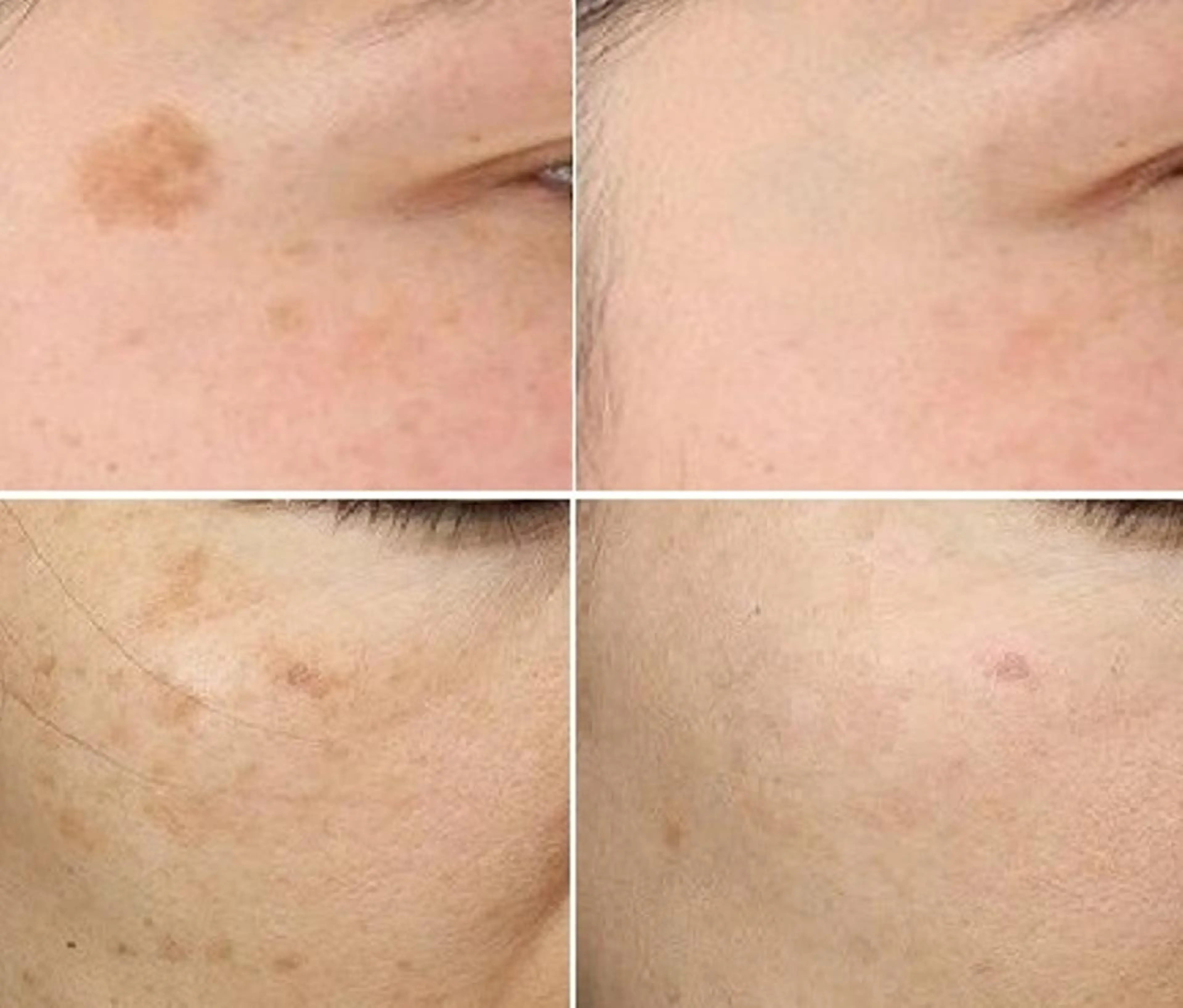 エステ 全身脱毛&VIO脱毛 紹介率№1♪リナ♪のエステ・リラクイメージ