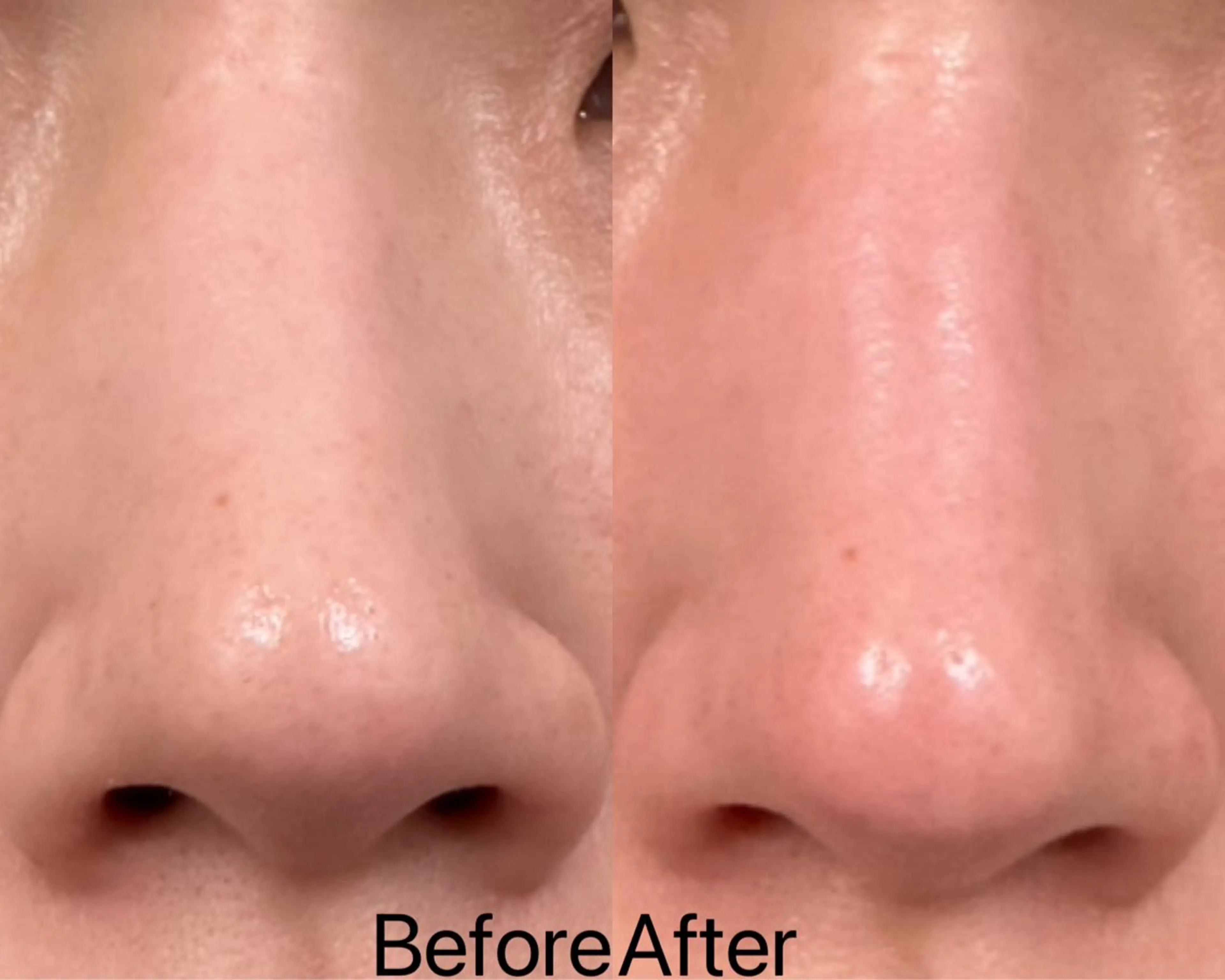 エステ リラク Ginza Charerのエステ・リラクイメージ