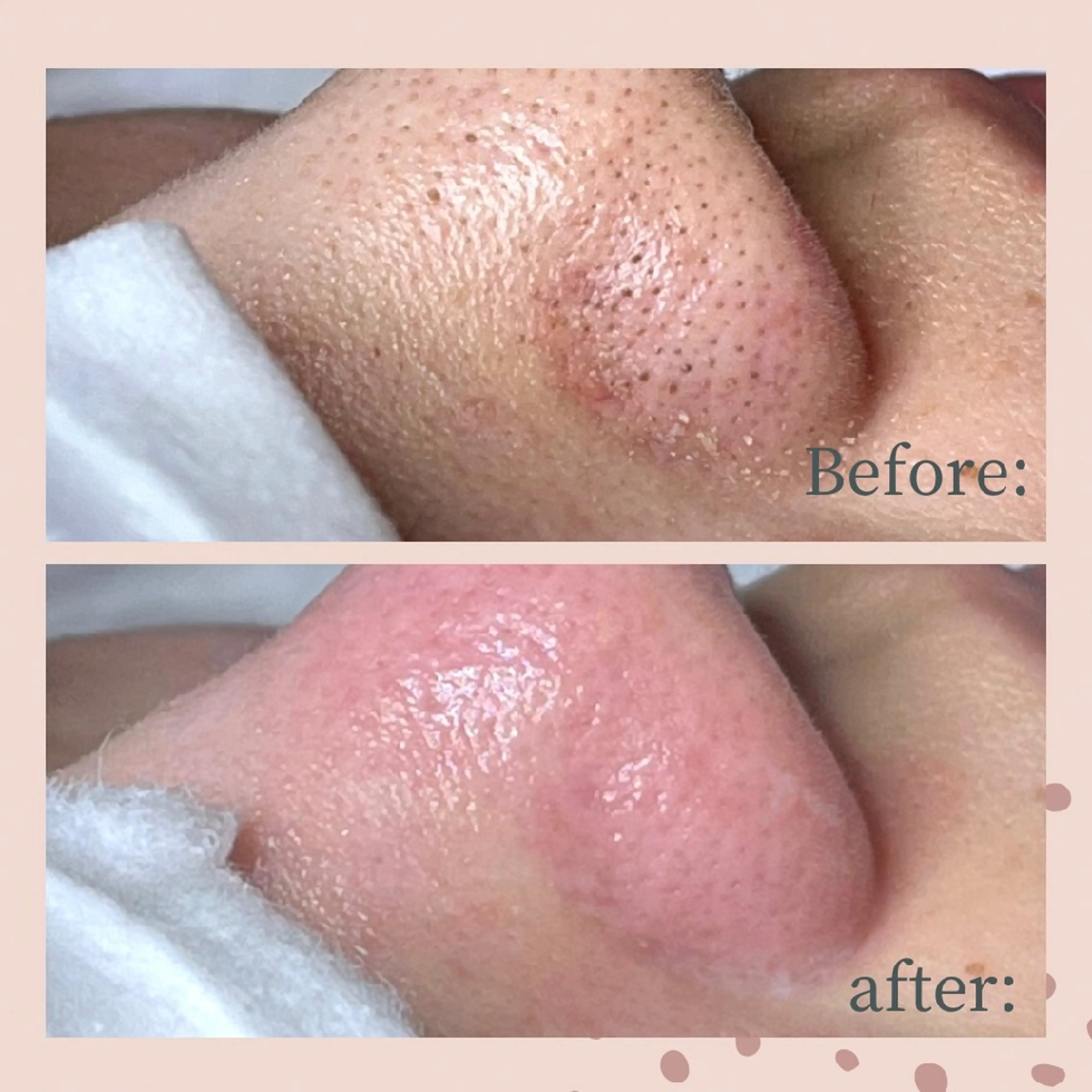 yon gypsophiraのエステ・リラクイメージ