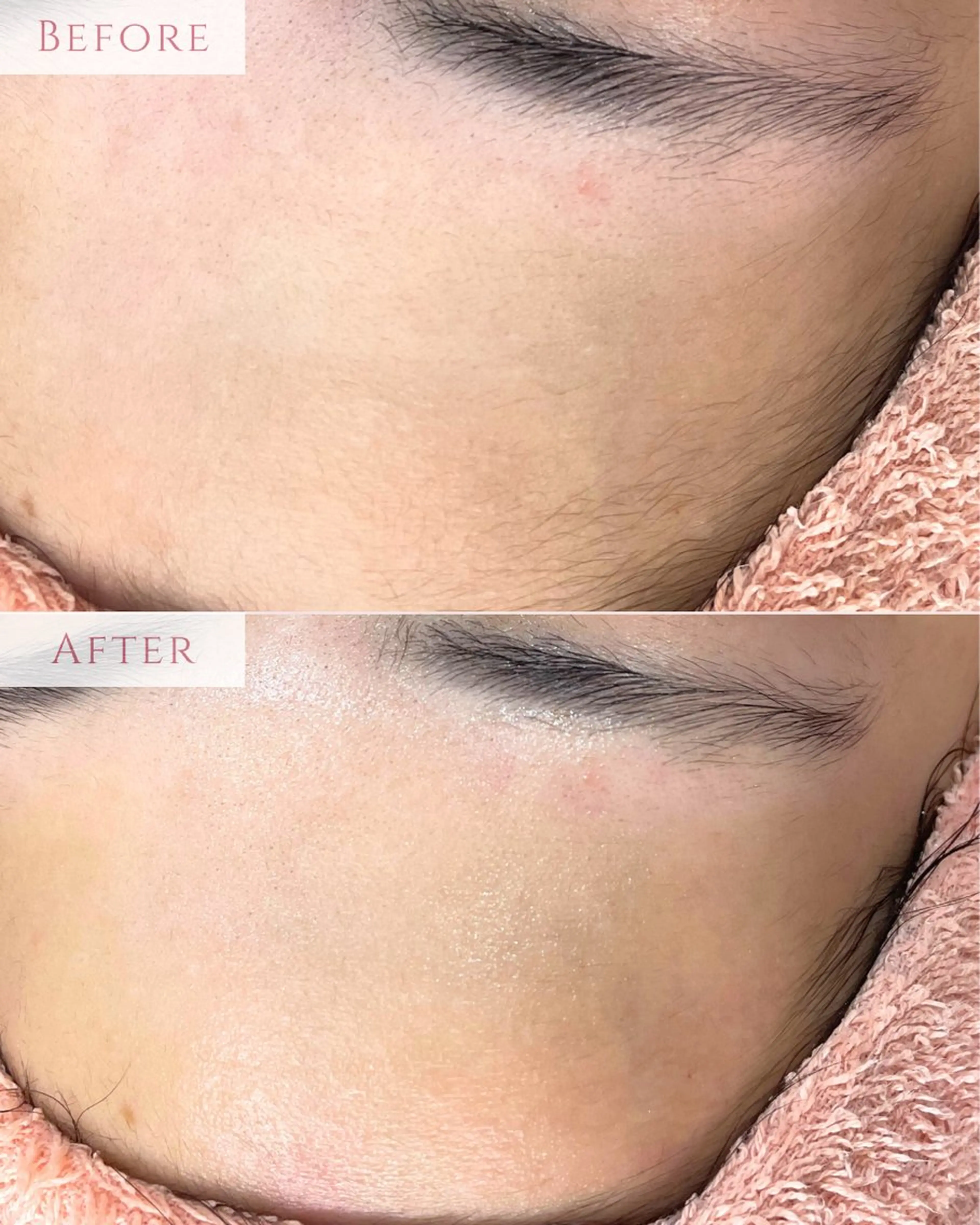 脱毛 肌質改善専門サロン Bellmi/心斎橋のエステ・リラクイメージ