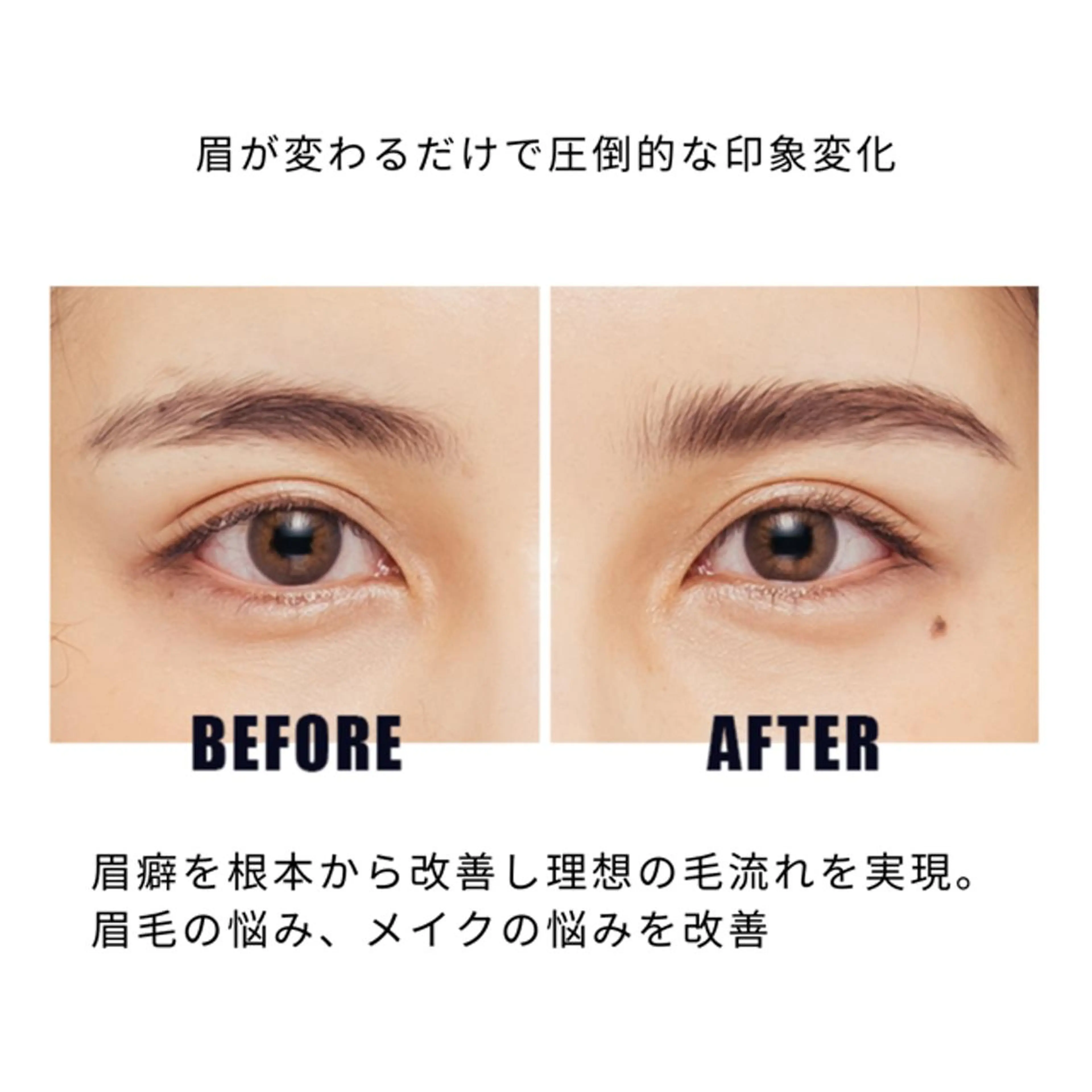 眉癖矯正の写真