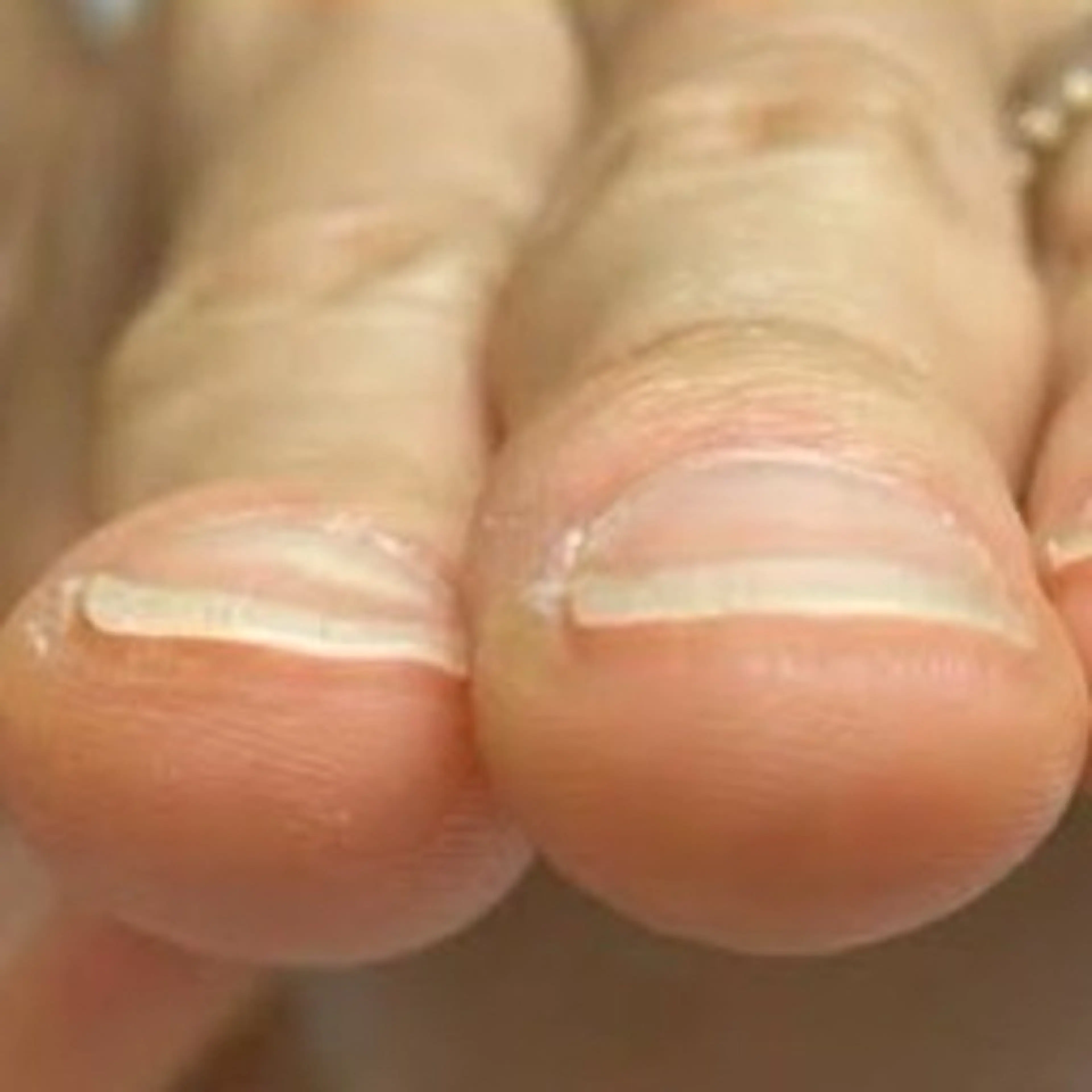 ネイル Y U K Iのネイルデザイン