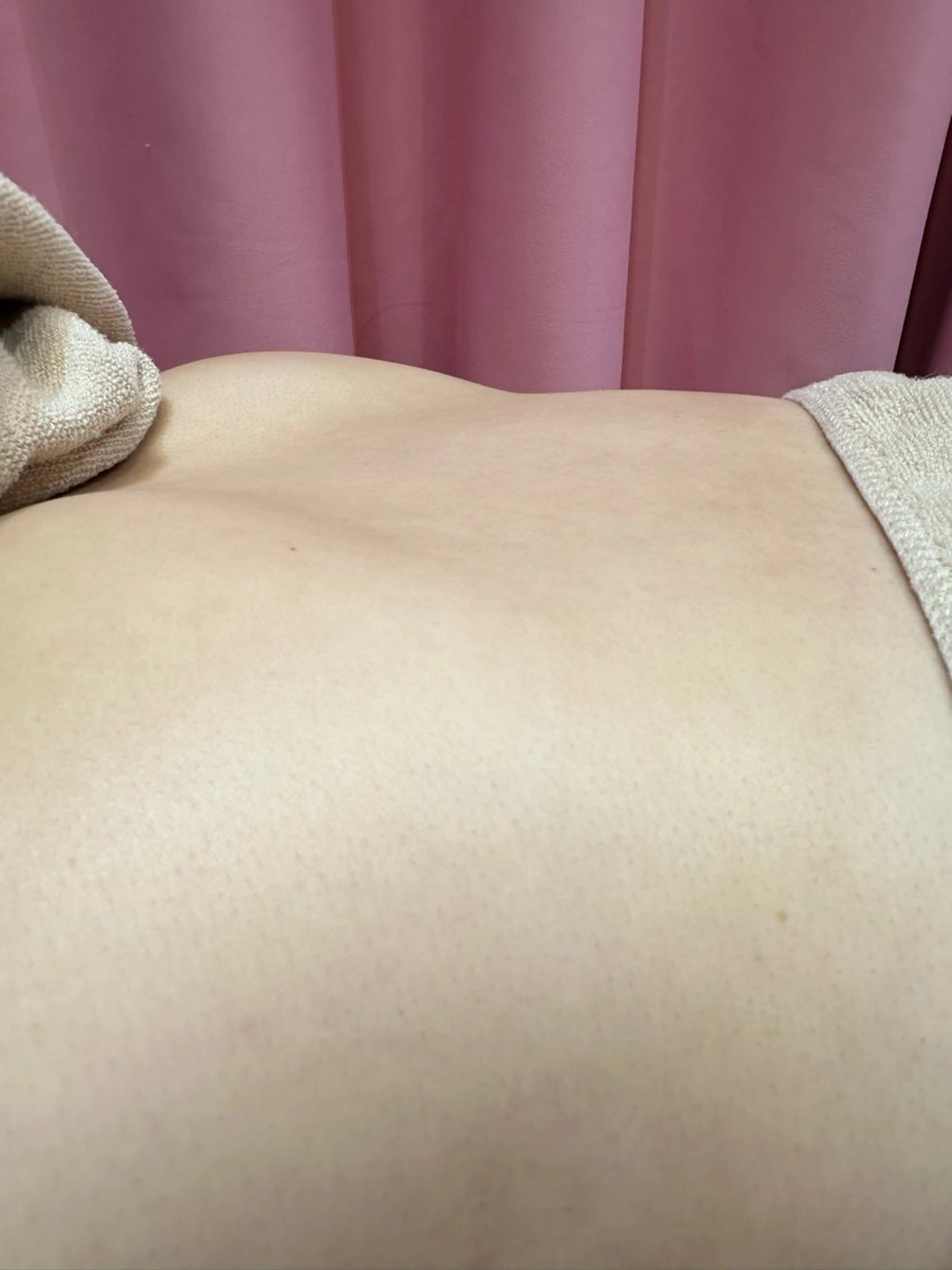 背中のケアにぜひ✨ミニモ限定クーポン🤭キャミラインシェービングの写真