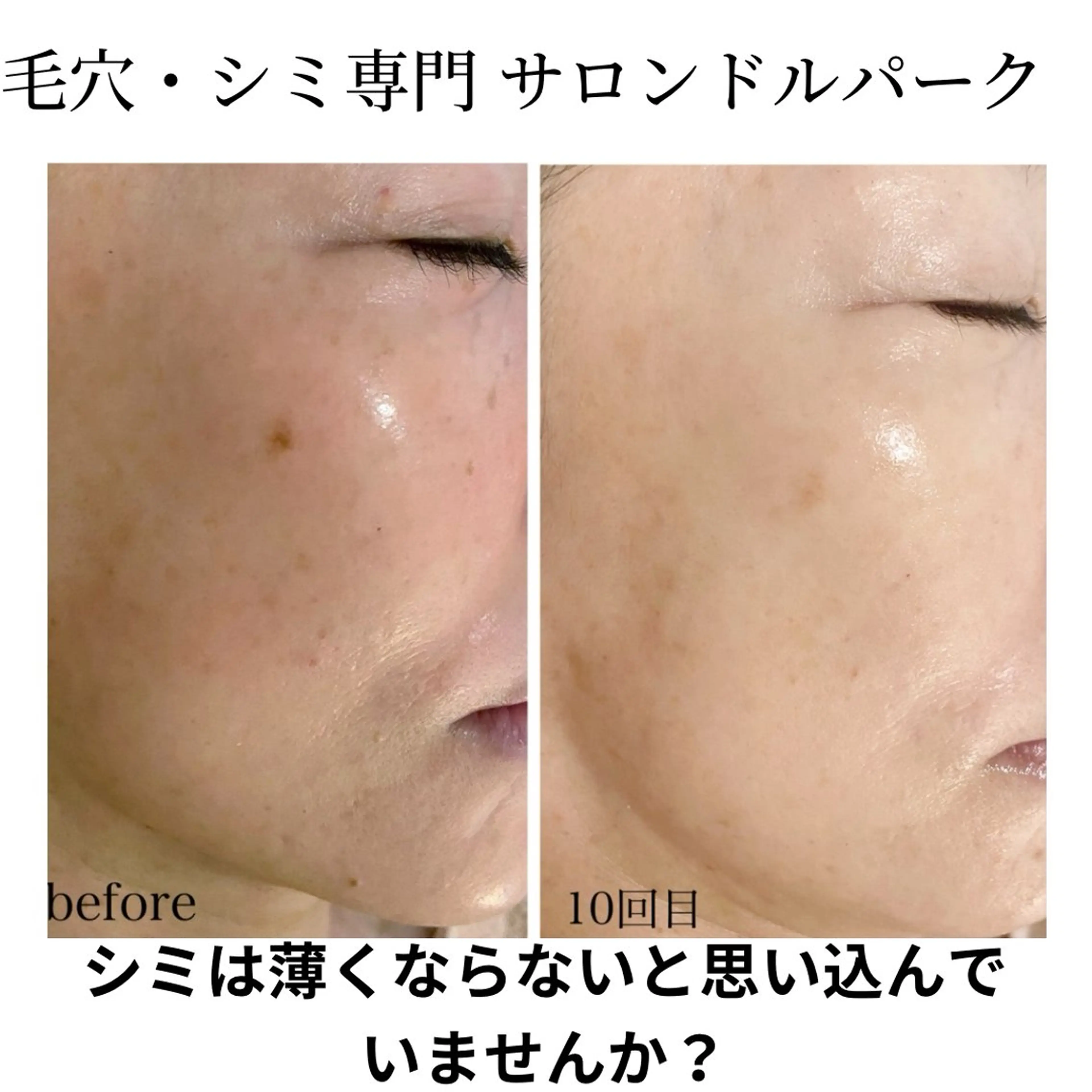 エステ 毛穴シミ改善専門 サロンド・ルパークのエステ・リラクイメージ