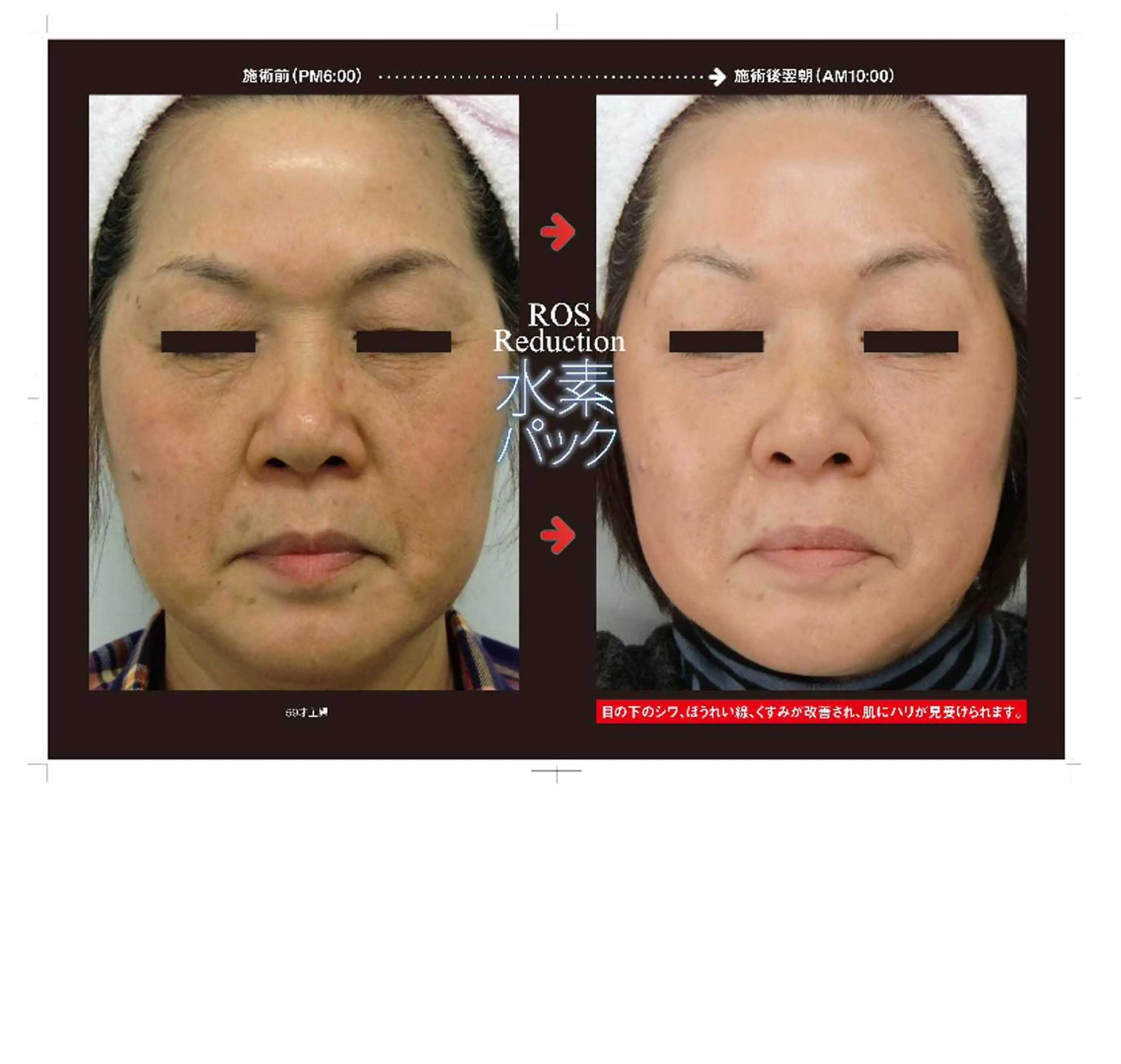 代表 MOMOのエステ・リラクイメージ