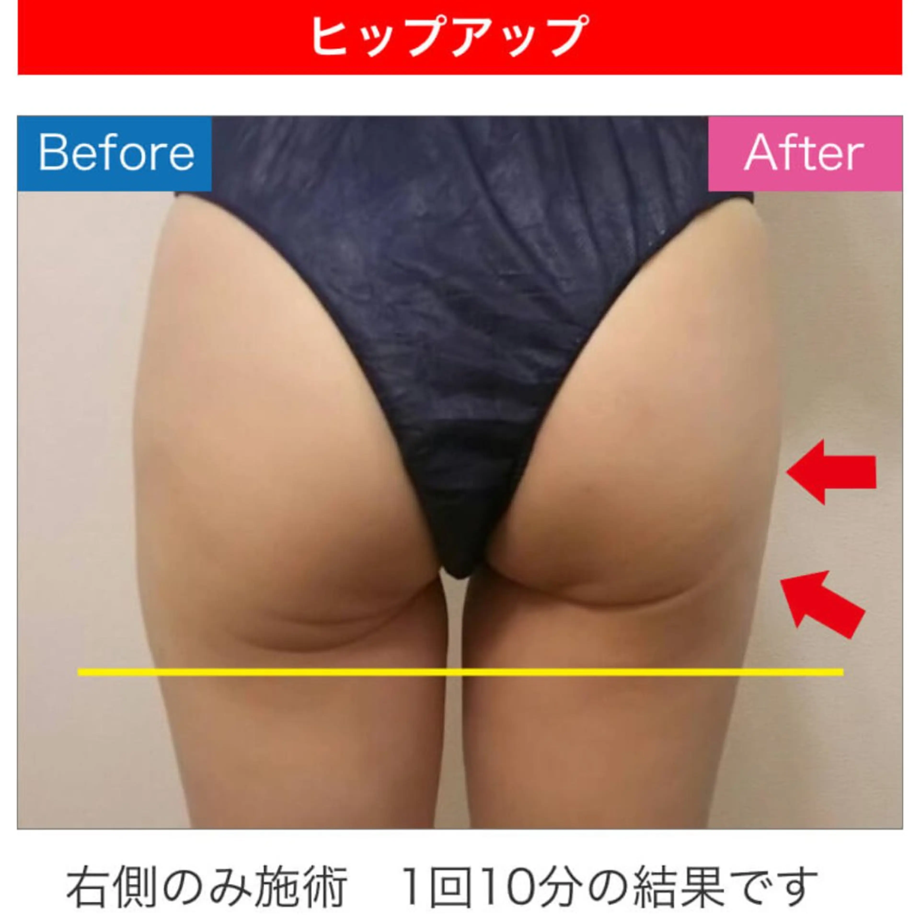 オフ:オン所属・オフ:オン 全身筋膜マッサージのエステ・リラクイメージ