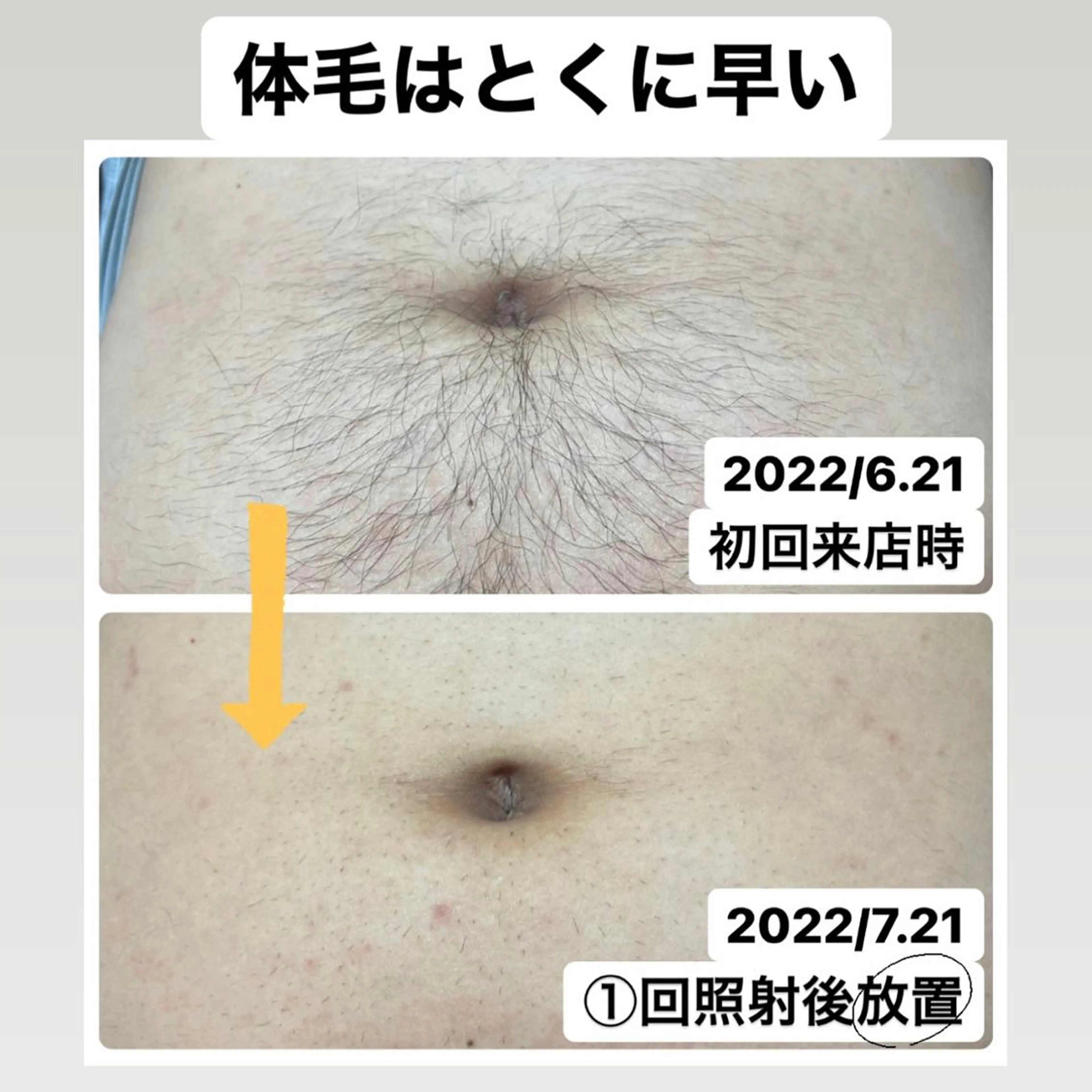 メンズ メンズハイライト 脱毛 メンズ脱毛サロン Le falcoのエステ・リラクイメージ