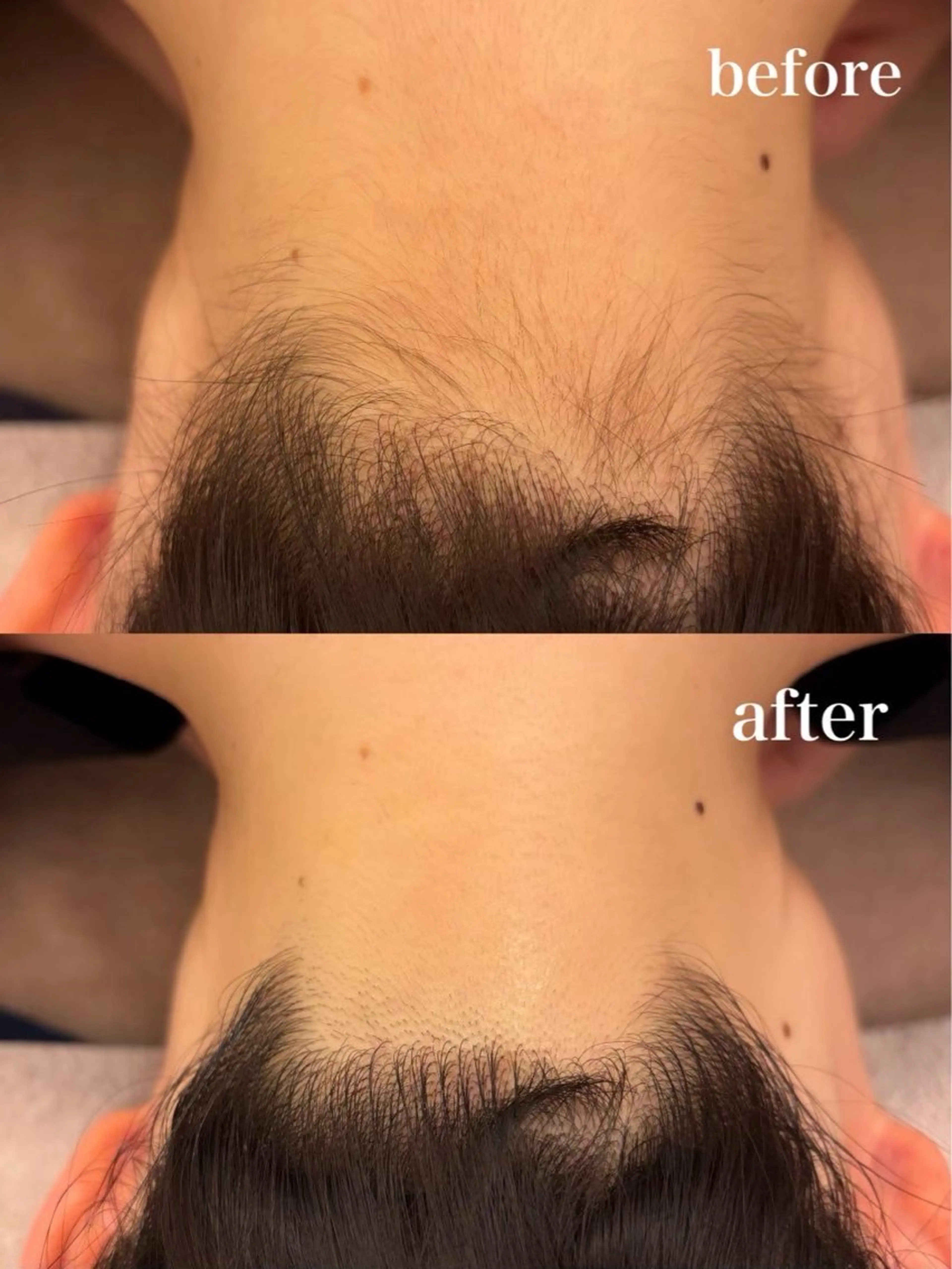 脱毛 石井 美々花のエステ・リラクイメージ