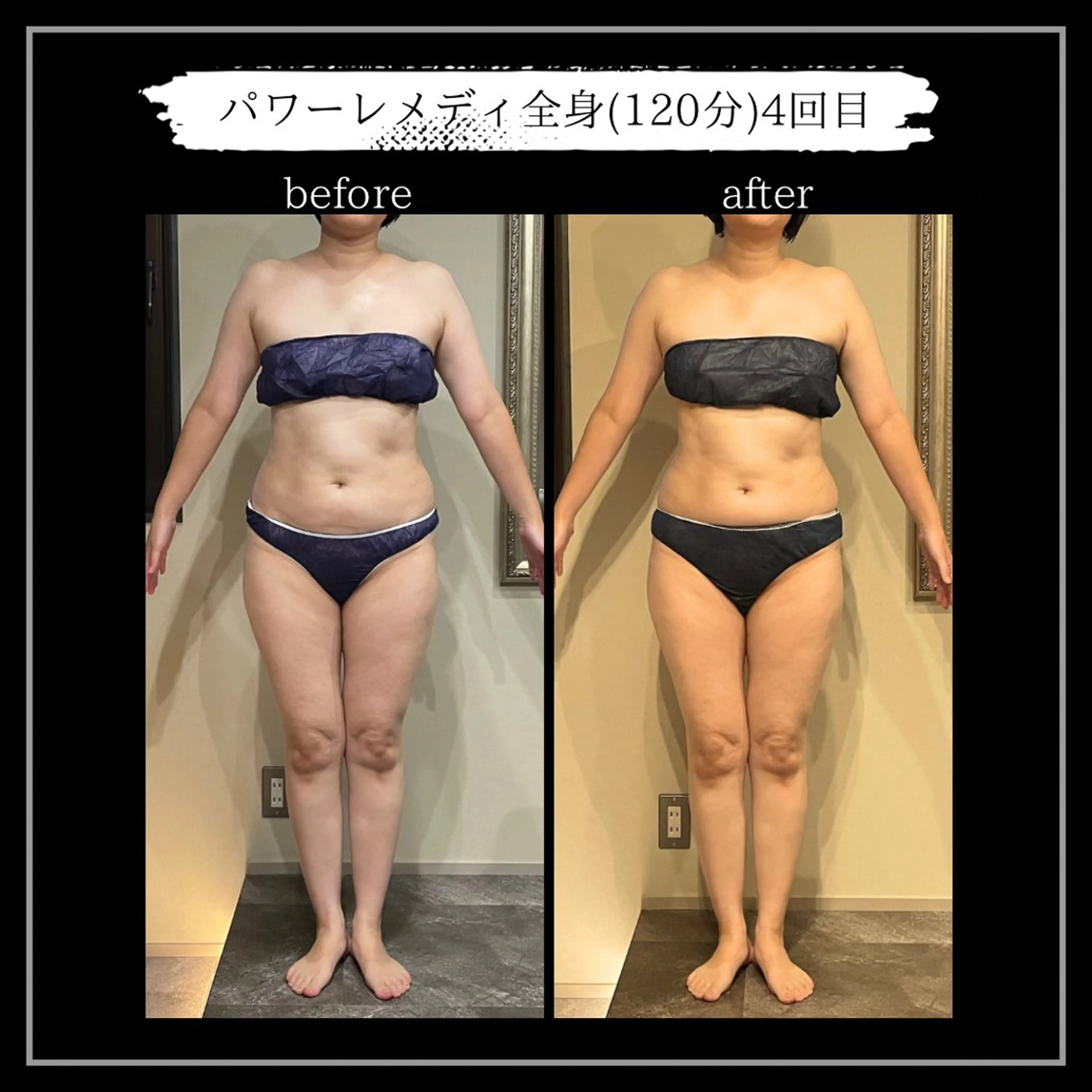 オフ:オン所属・オフ:オン 全身筋膜マッサージのエステ・リラクイメージ