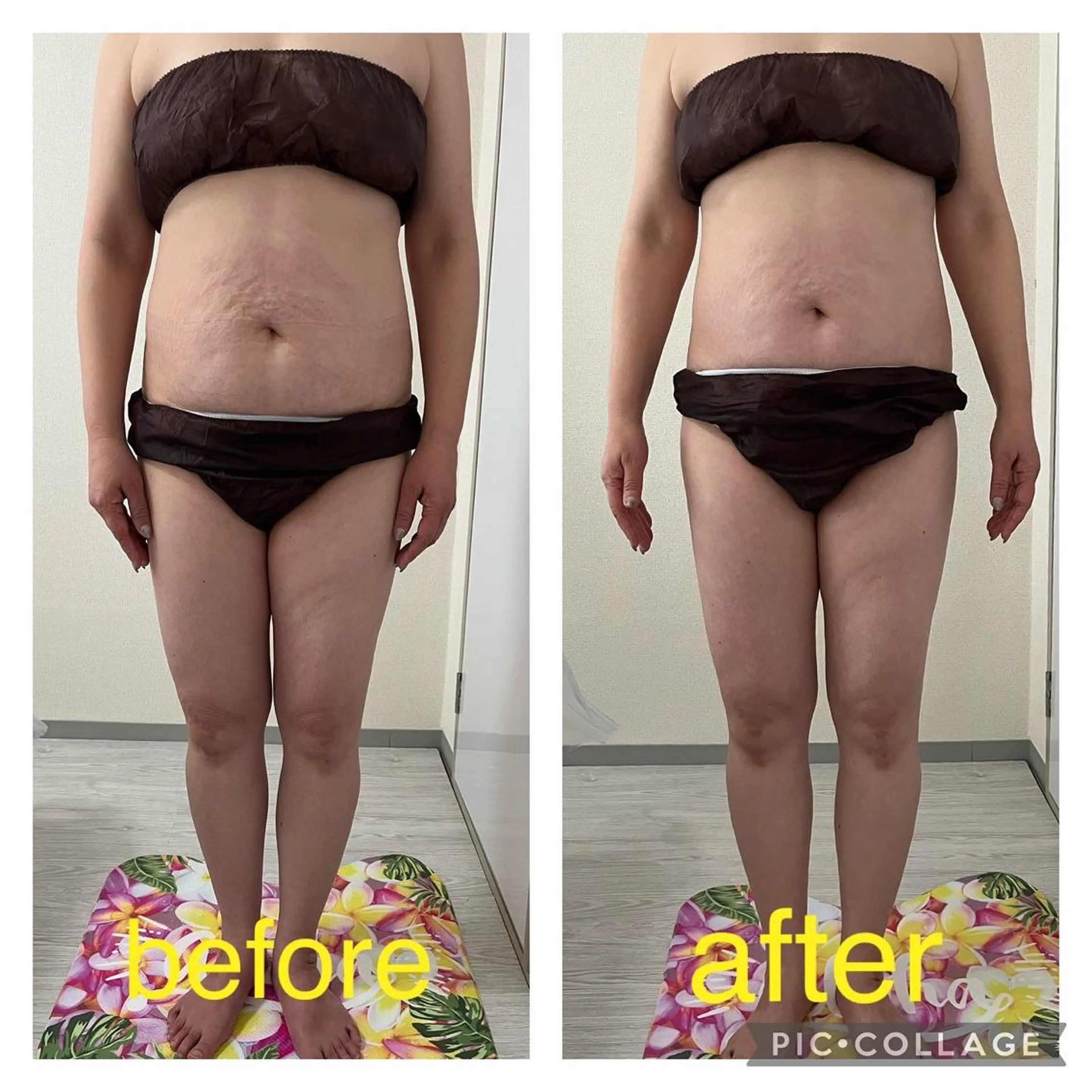 エステ リラク marrina terraceのその他イメージ