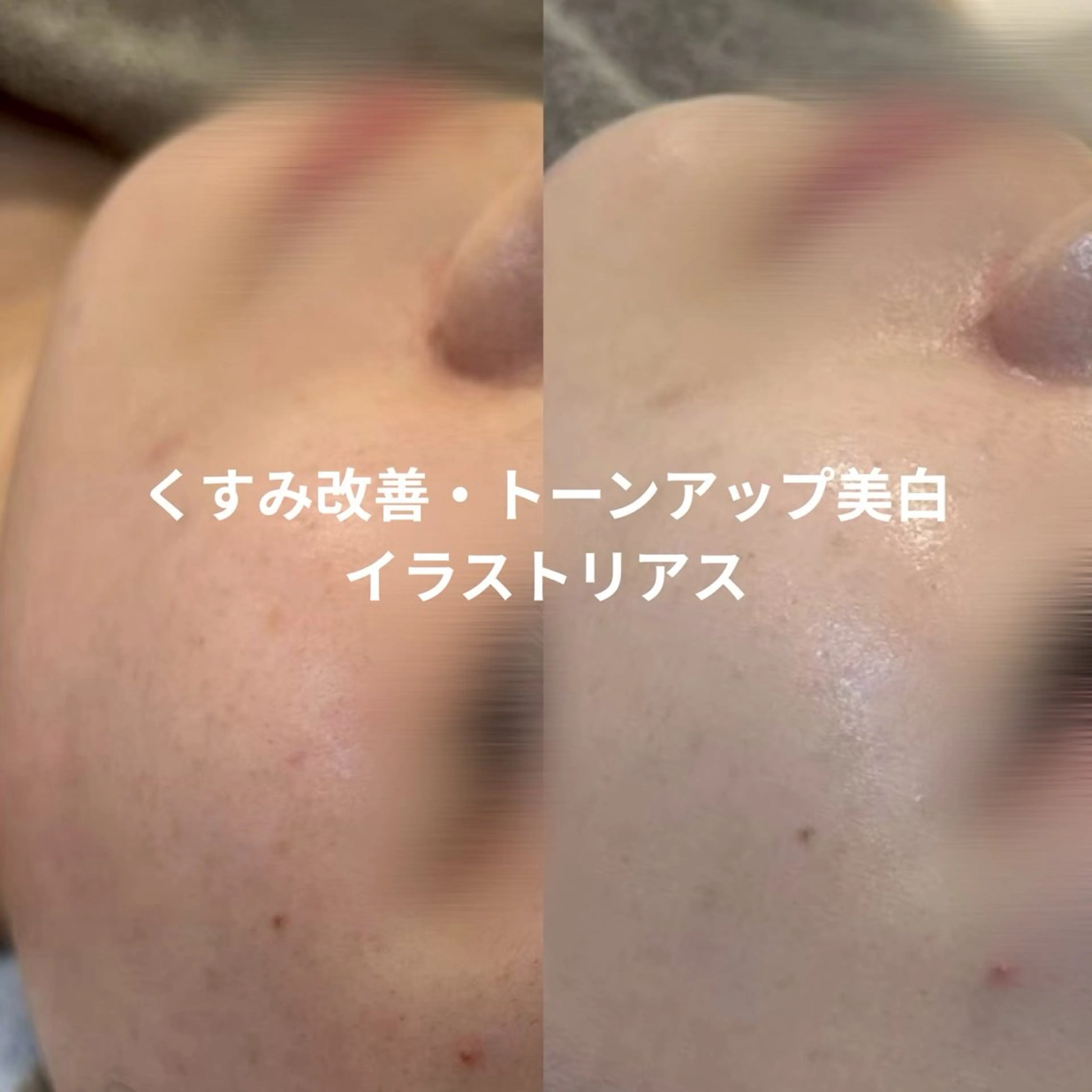 クリスティーナ イラストリアス|シミ・美白ケアの写真