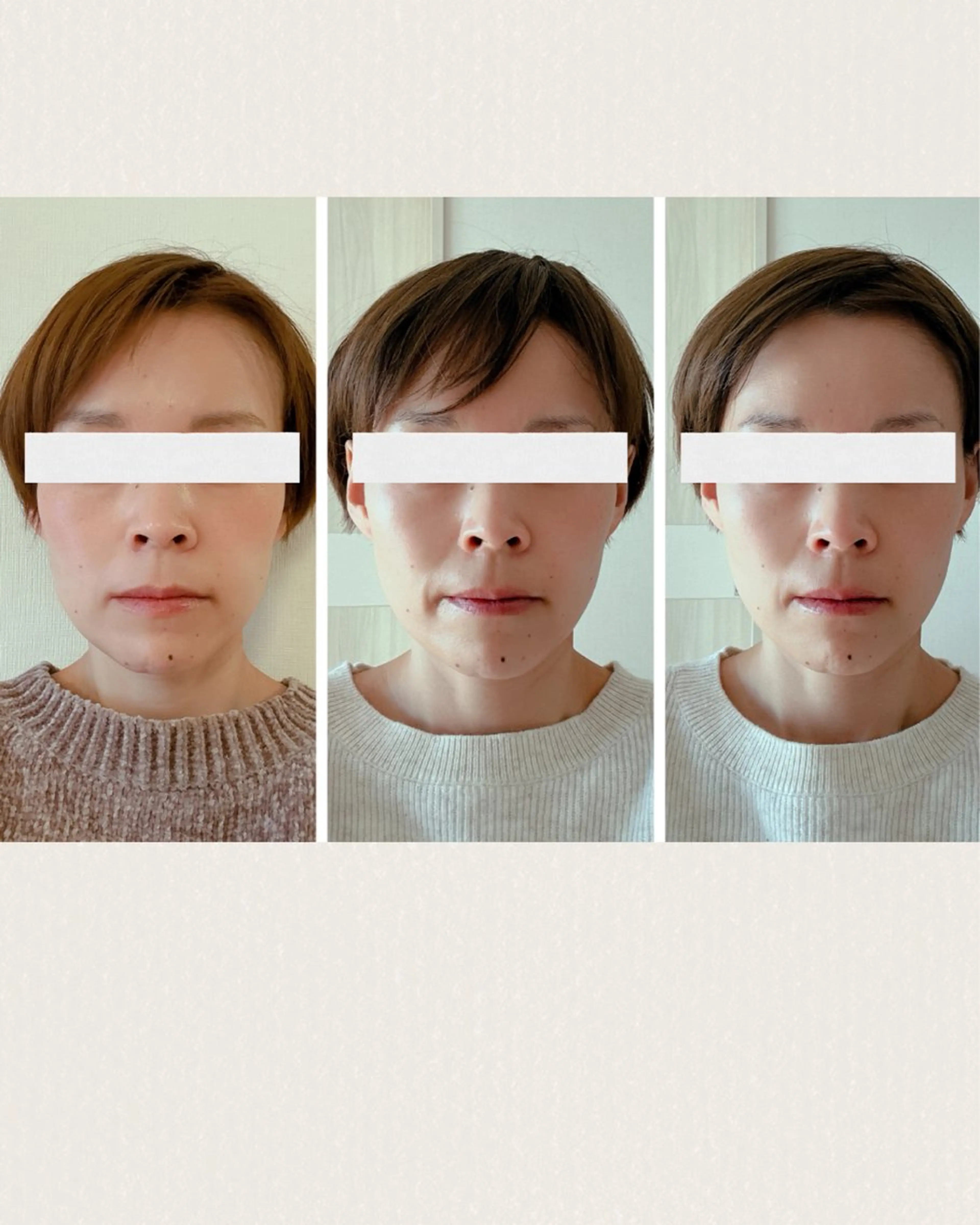 【ご新規様💎限定】本格✨痛くないお顔の骨格矯正+リンパケア(顔・足)90分の写真